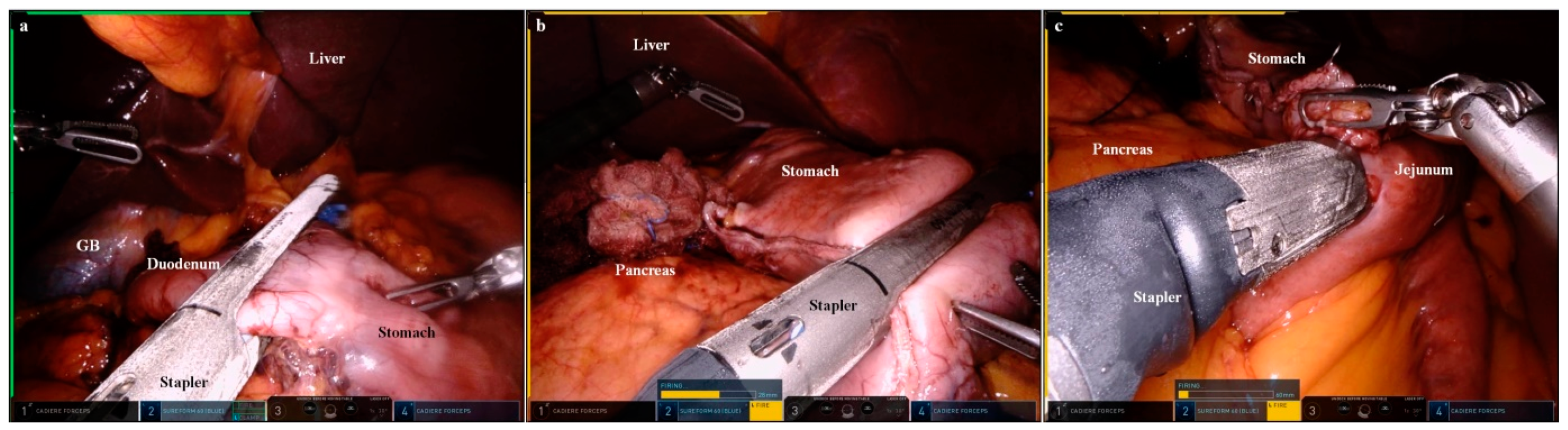 Cancers 15 05371 g003