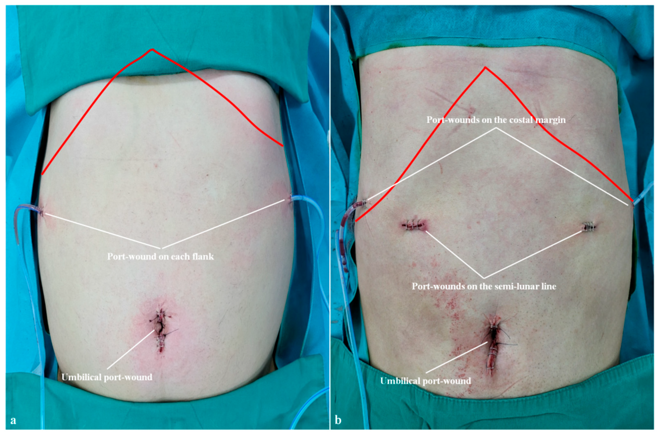 Cancers 15 05371 g004