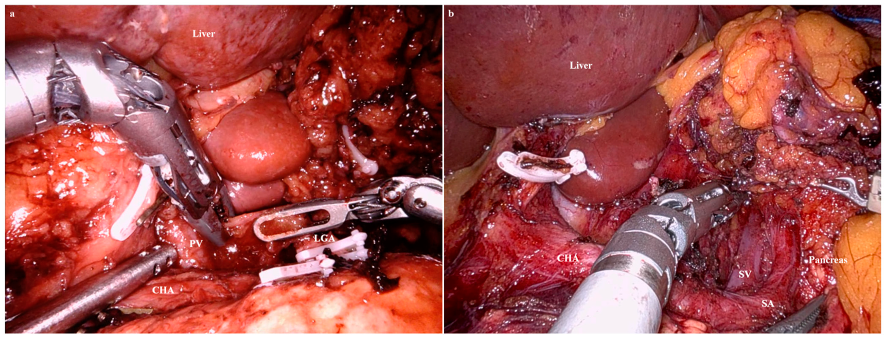 Cancers 15 05371 g005