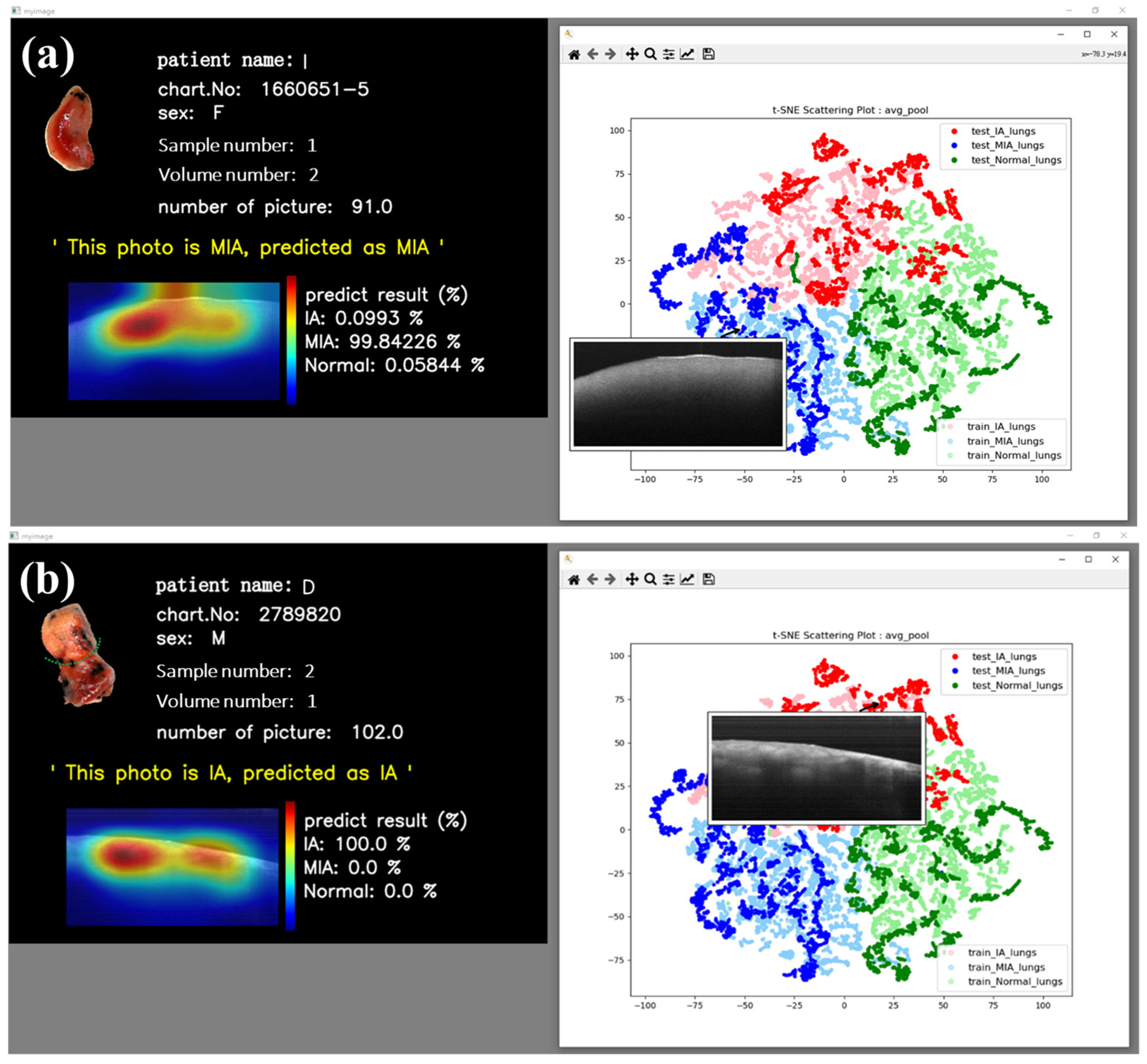 Cancers 15 05388 g007