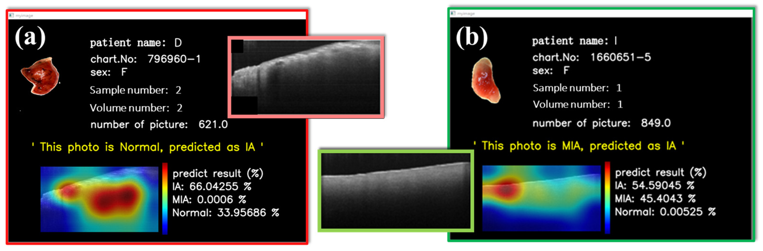 Cancers 15 05388 g009