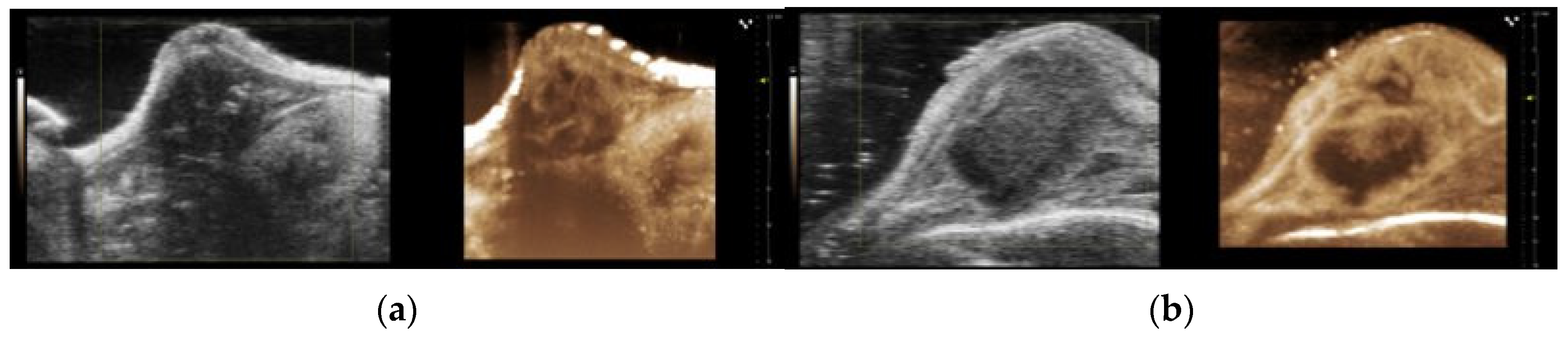 Cancers 15 05415 g008