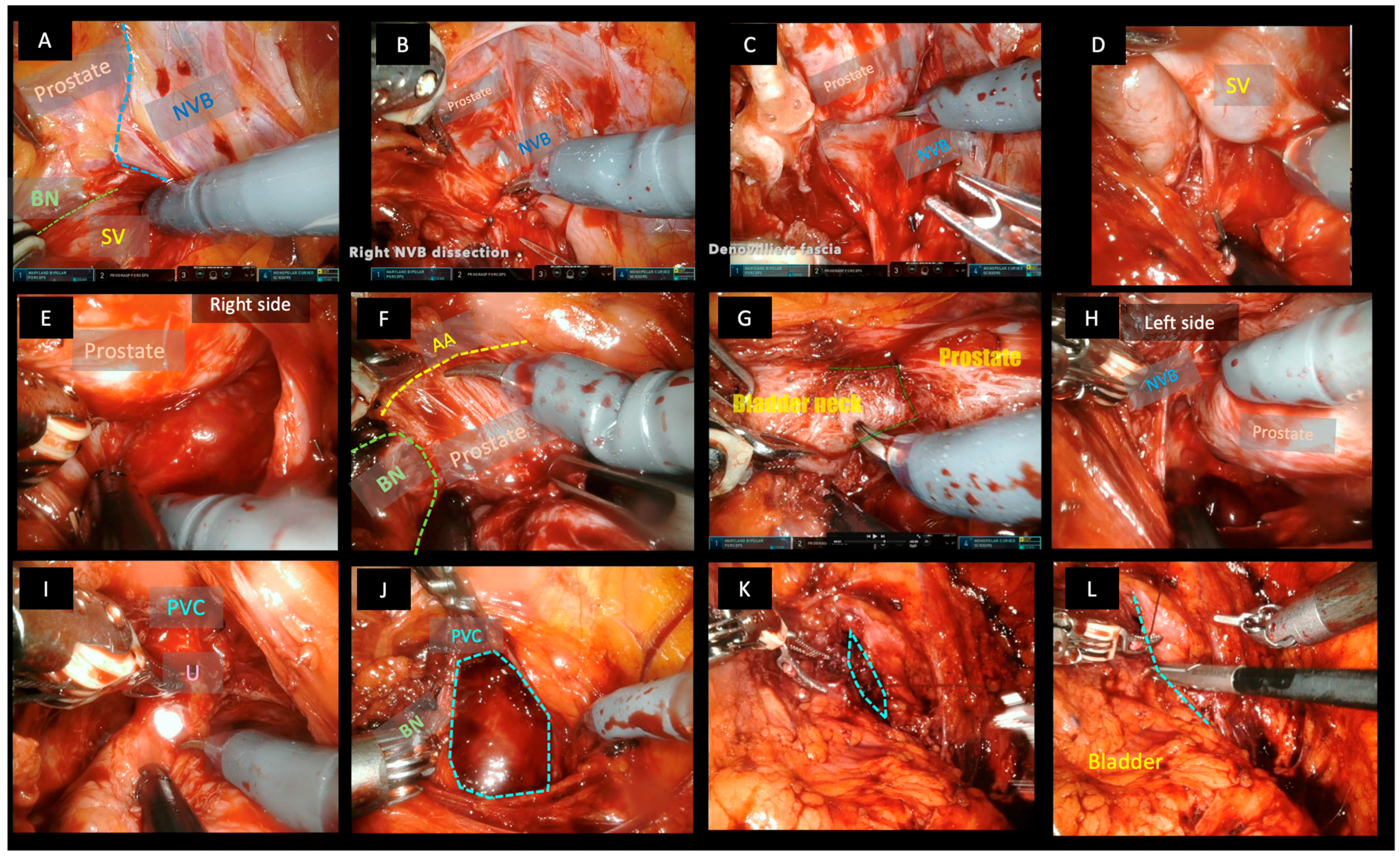 Cancers 15 05442 g001