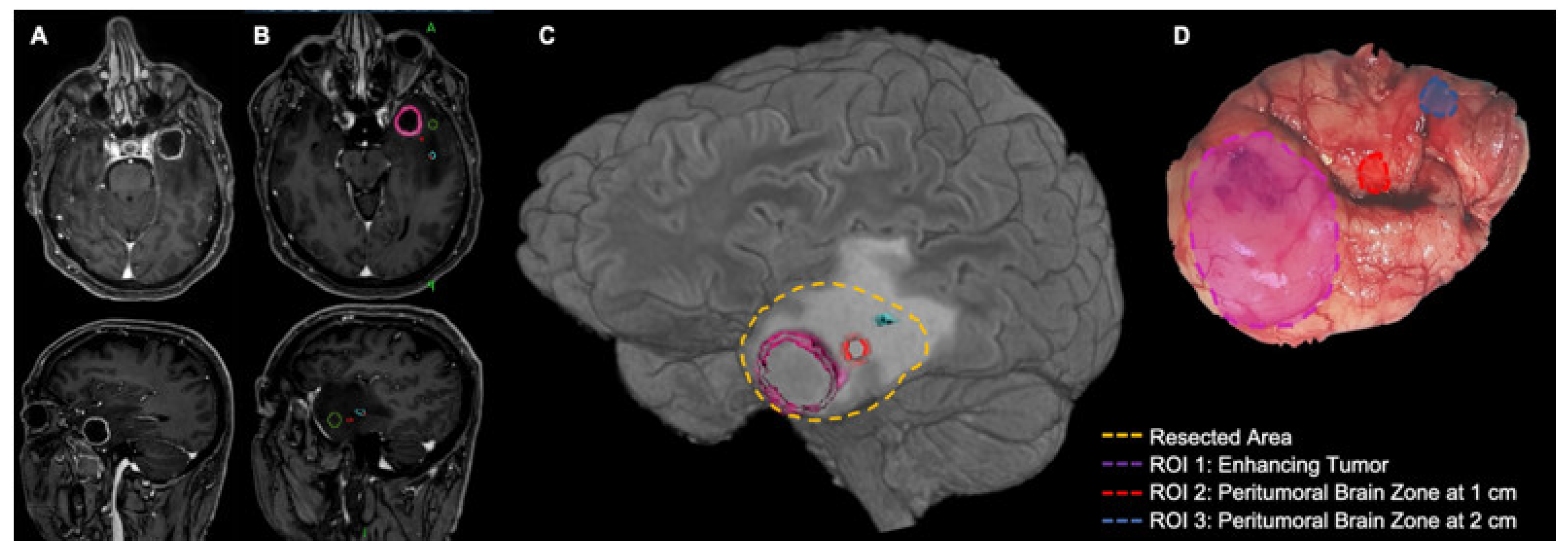 Cancers 15 05460 g001 Cancers 15 05460 g001