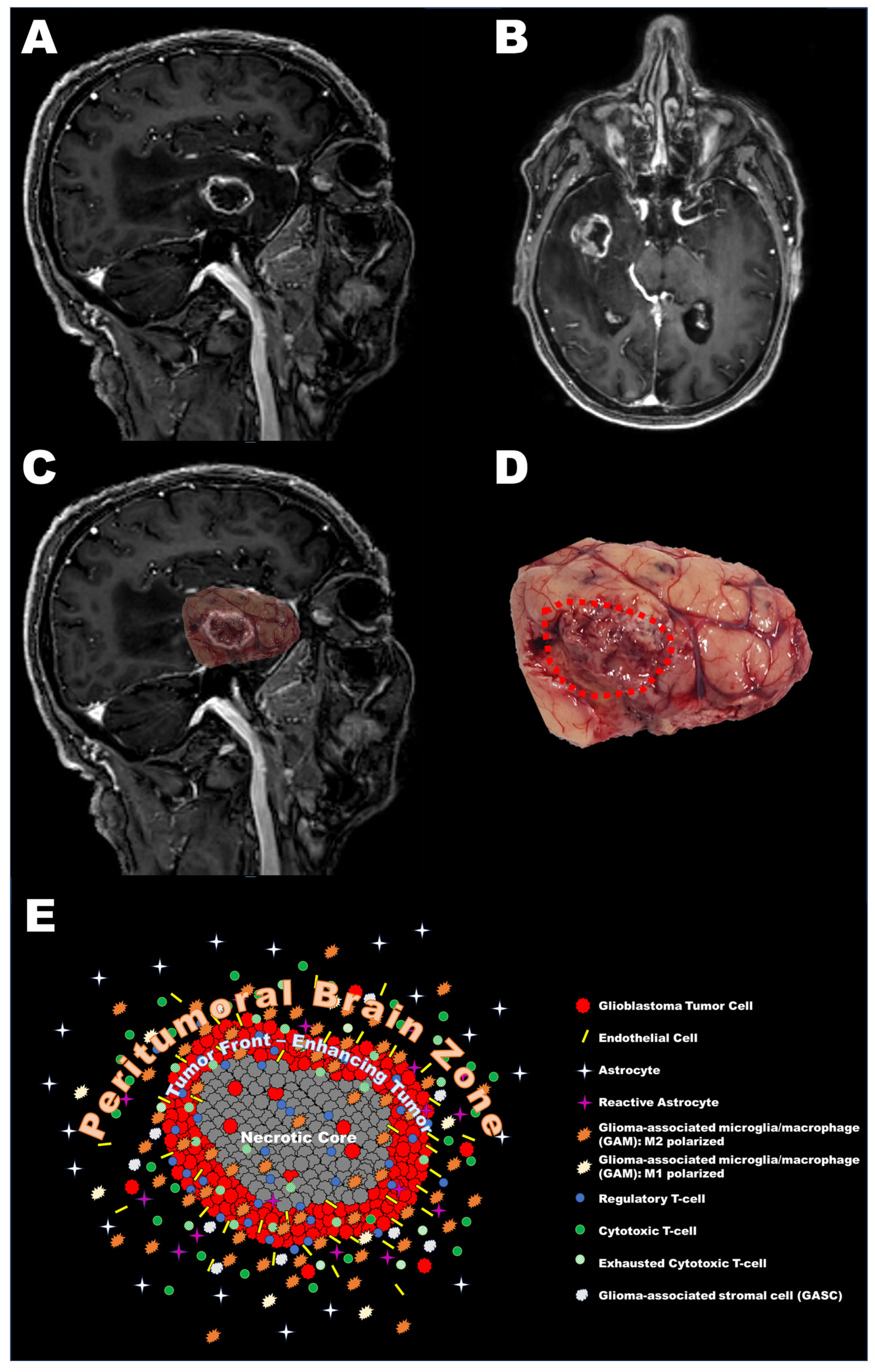 Cancers 15 05460 g002 Cancers 15 05460 g002