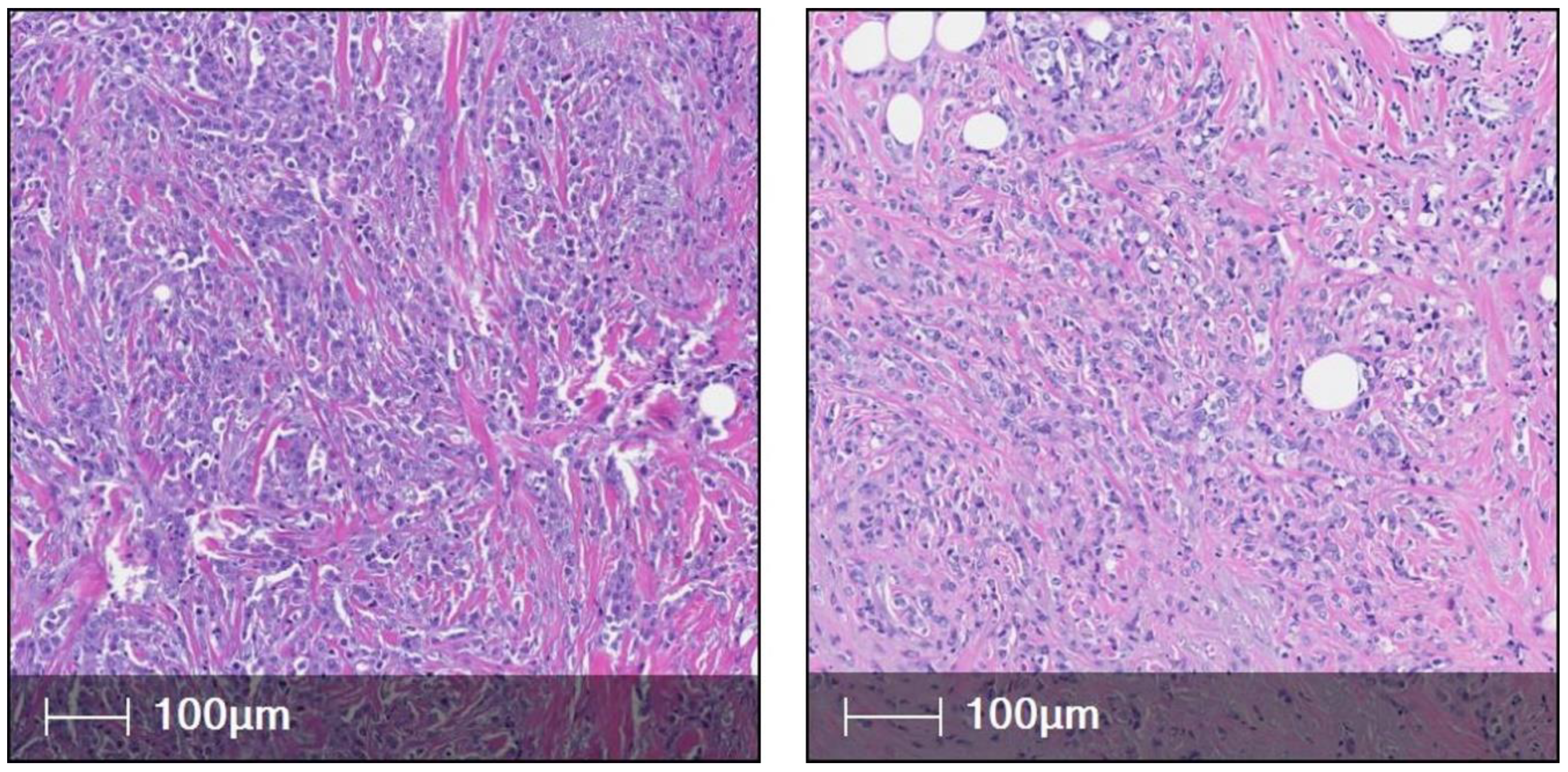 Cancers 15 05491 g003