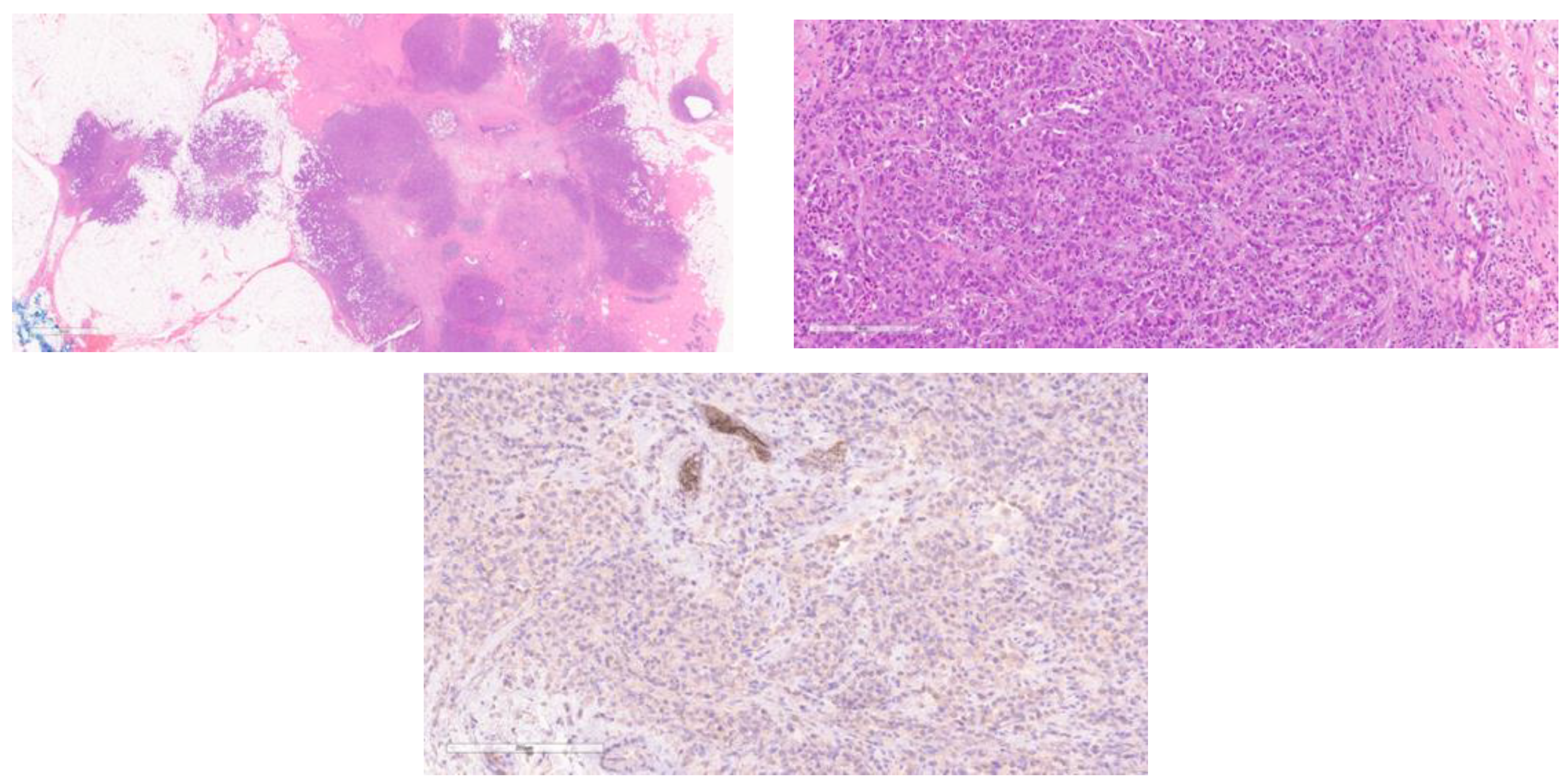 Cancers 15 05491 g005