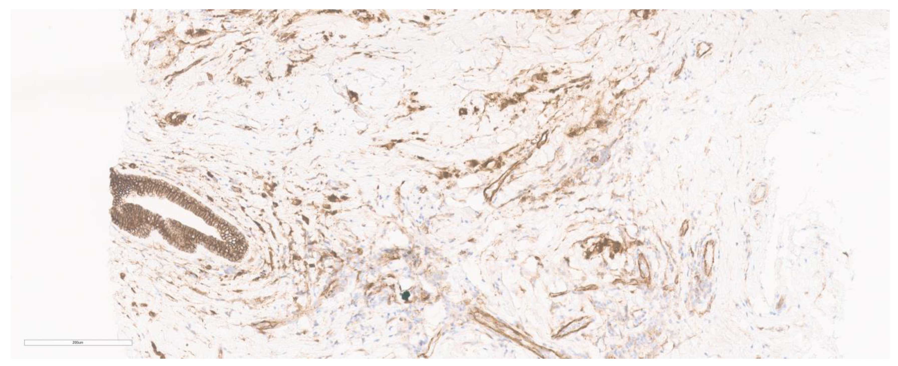 Cancers 15 05491 g007