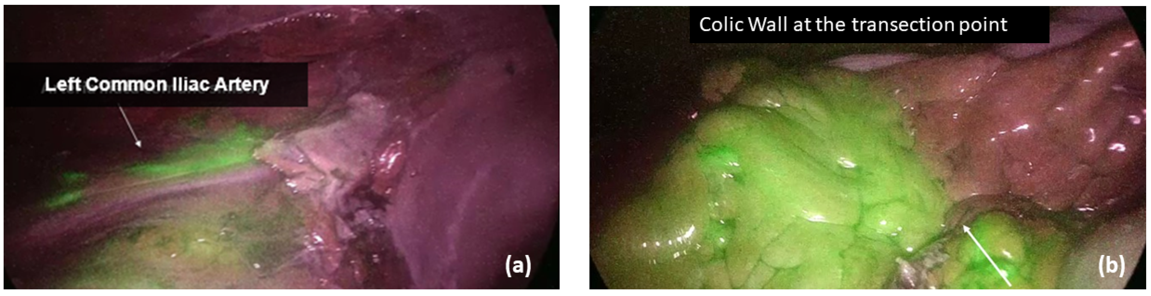 Cancers 15 05528 g001