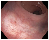 Cancers 15 05535 i002