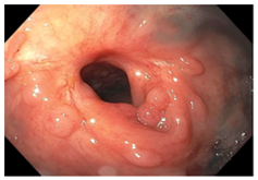 Cancers 15 05535 i008