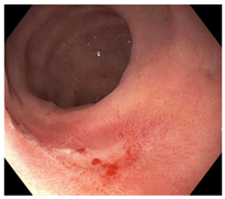 Cancers 15 05535 i012