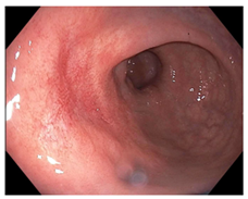 Cancers 15 05535 i013