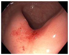 Cancers 15 05535 i014