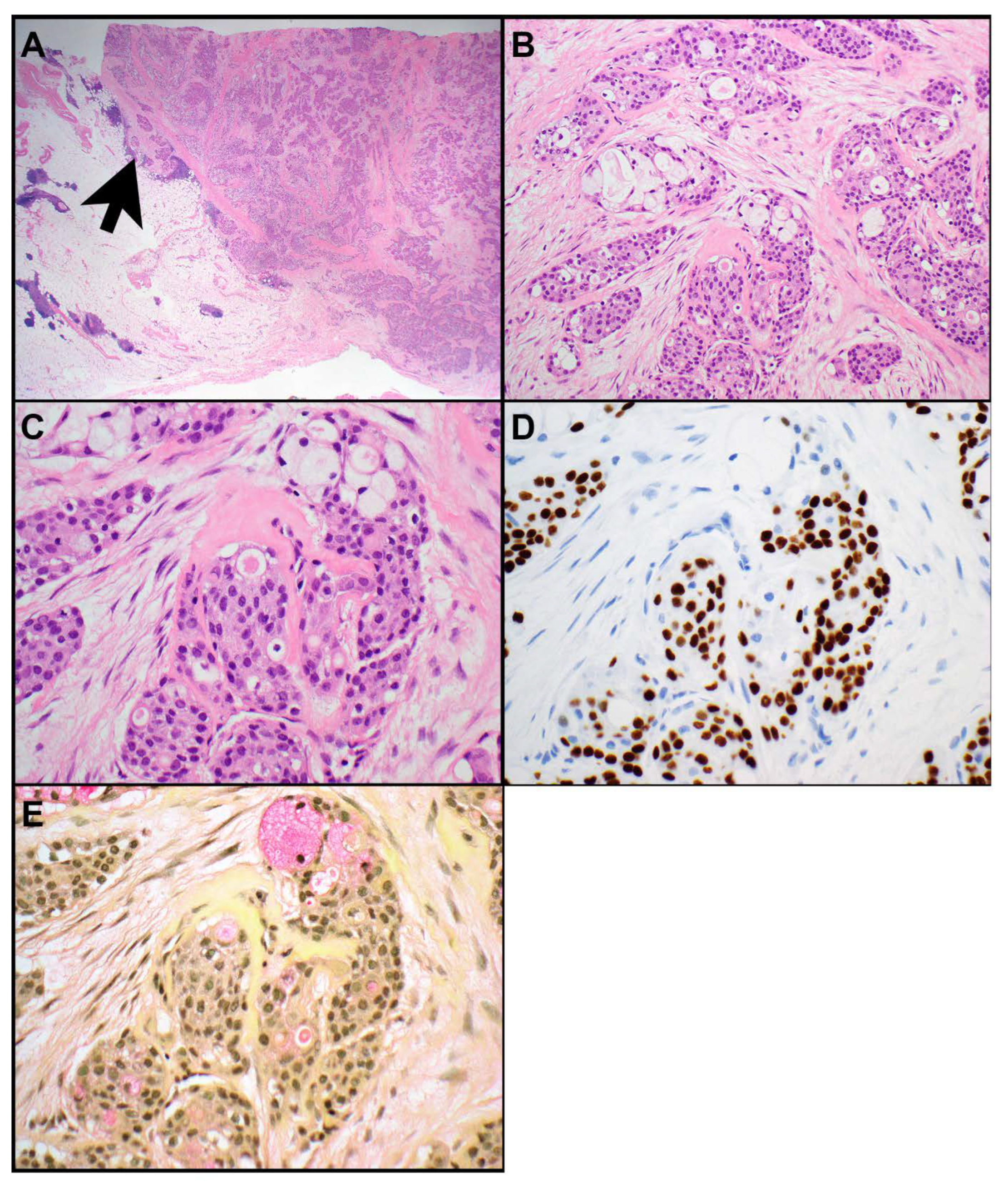 Cancers 15 05596 g001