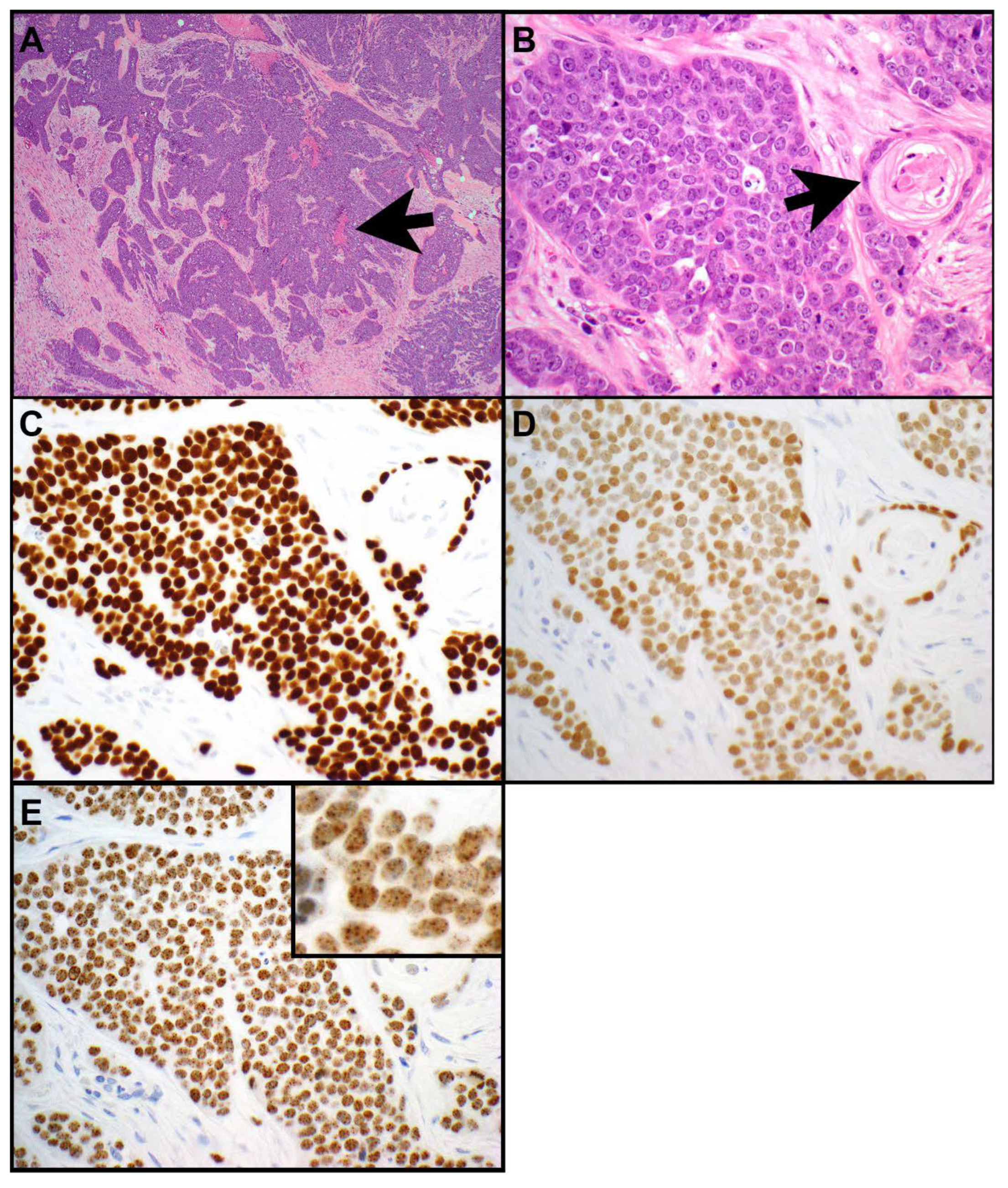 Cancers 15 05596 g003