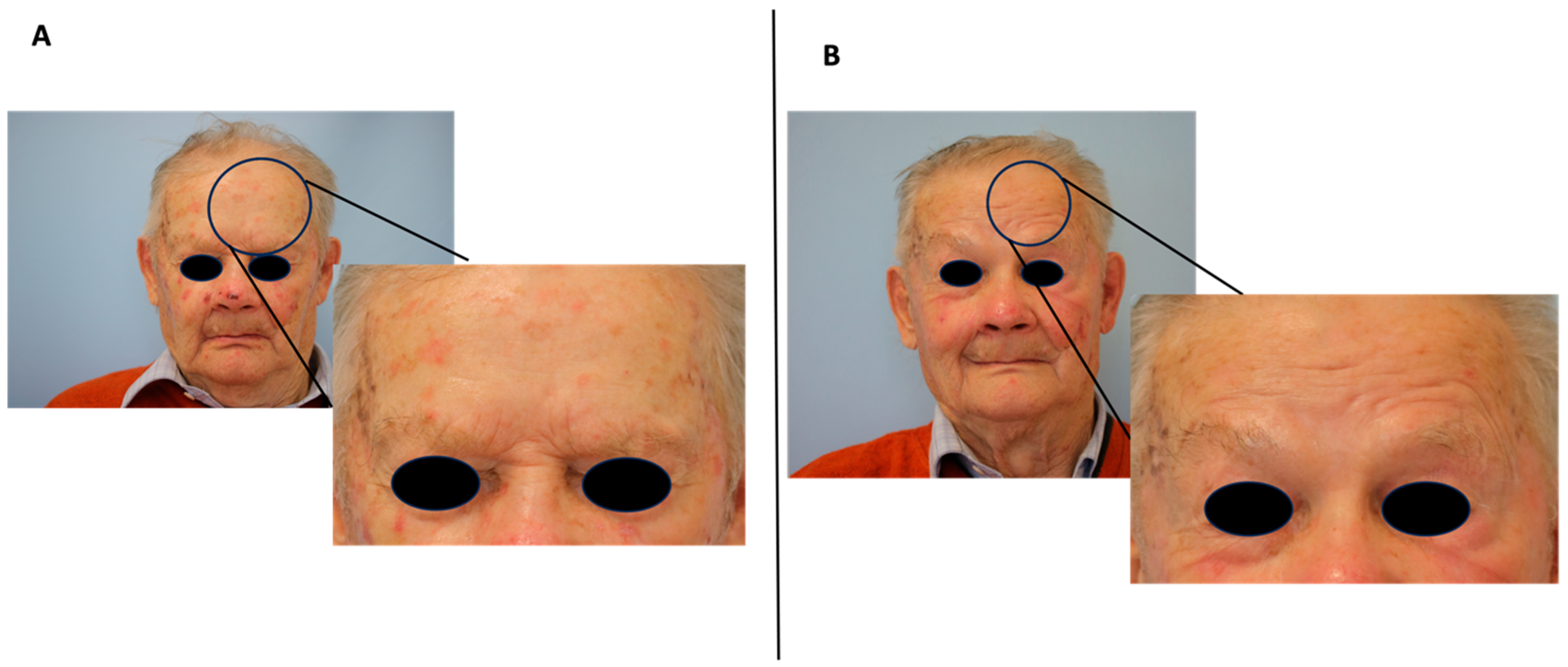 Cancers 15 05598 g001 Cancers 15 05598 g001