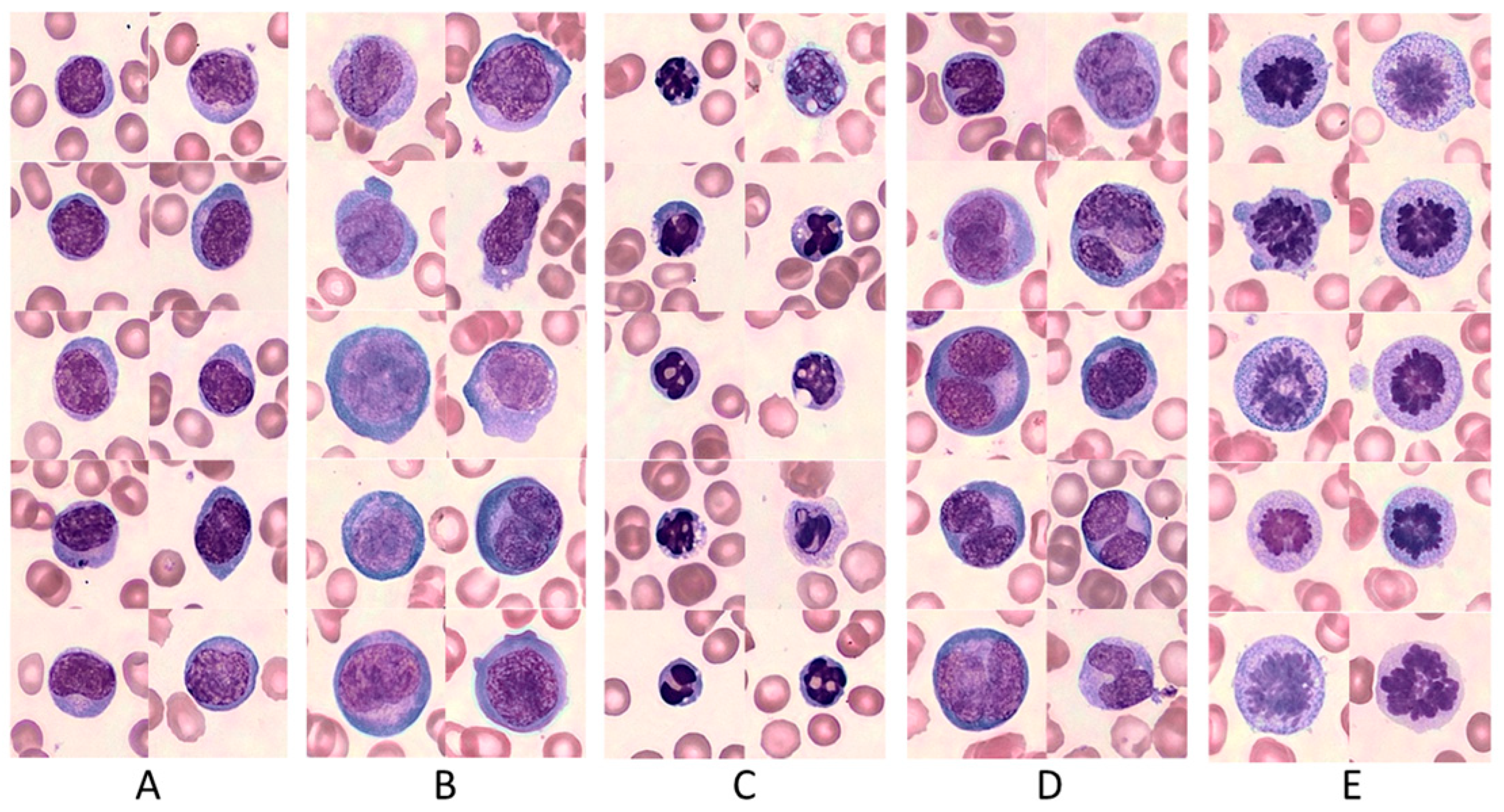 Cancers 15 05611 g001