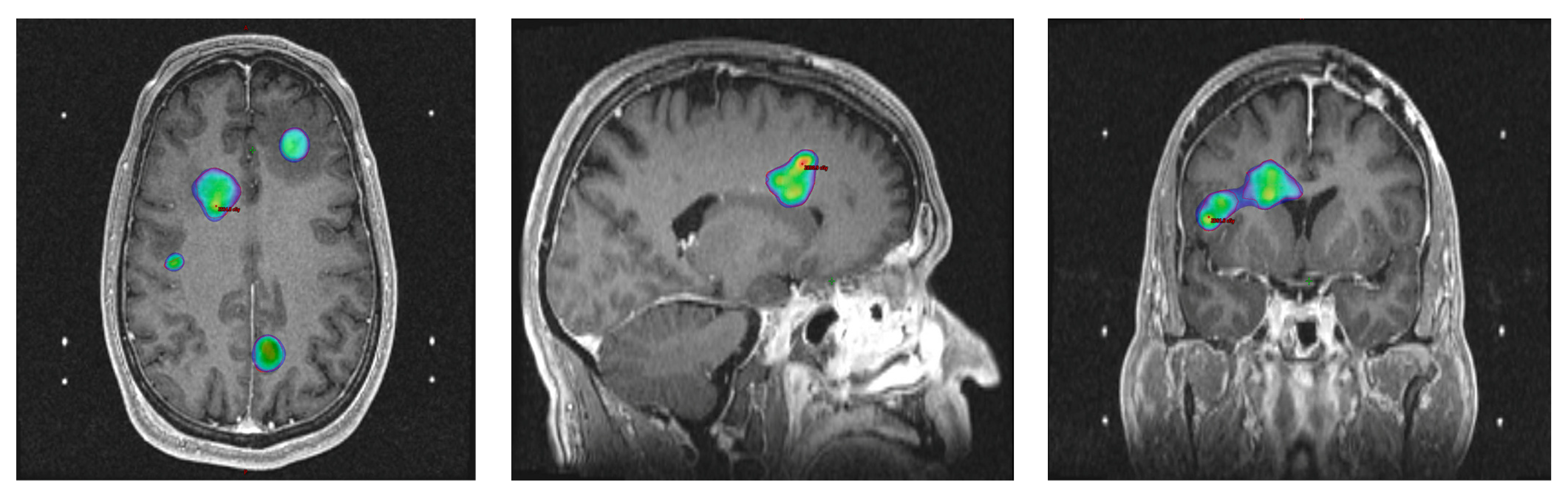 Cancers 15 05650 g002