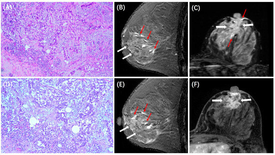 ゆん Enhanced Muscle Fibers of Epinephelus coioides by Myostatin