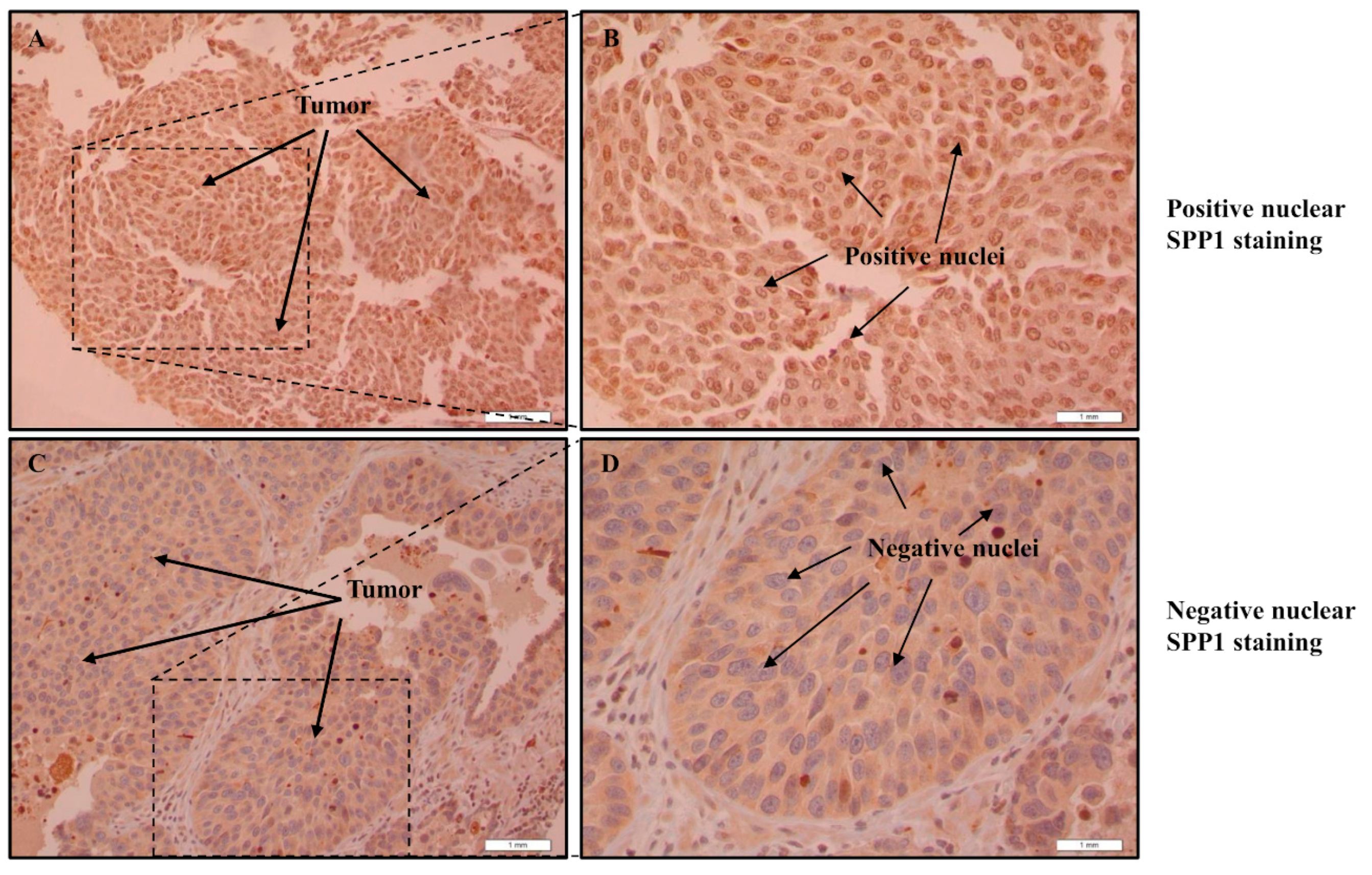 Cancers 15 05704 g004