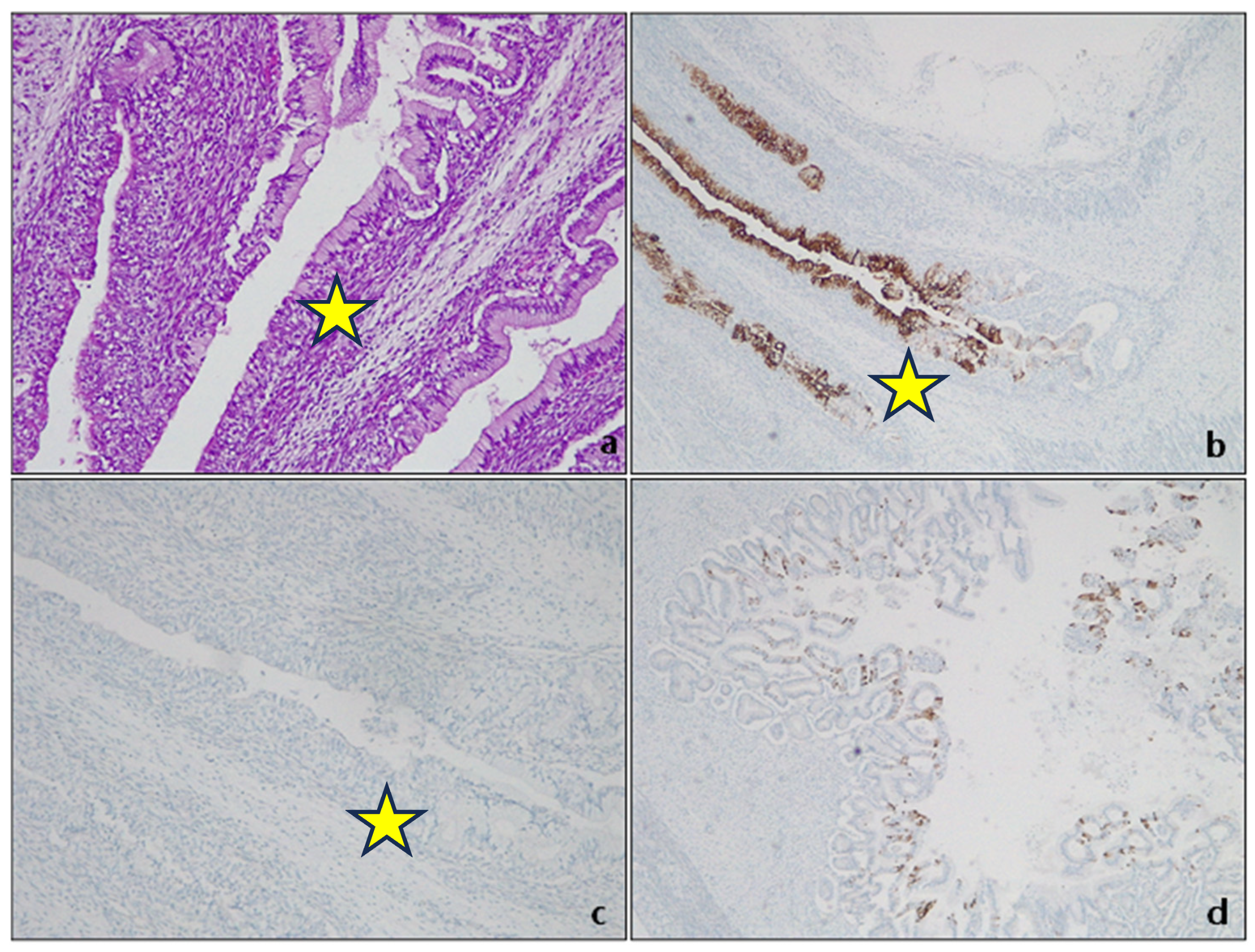 Cancers 15 05725 g001