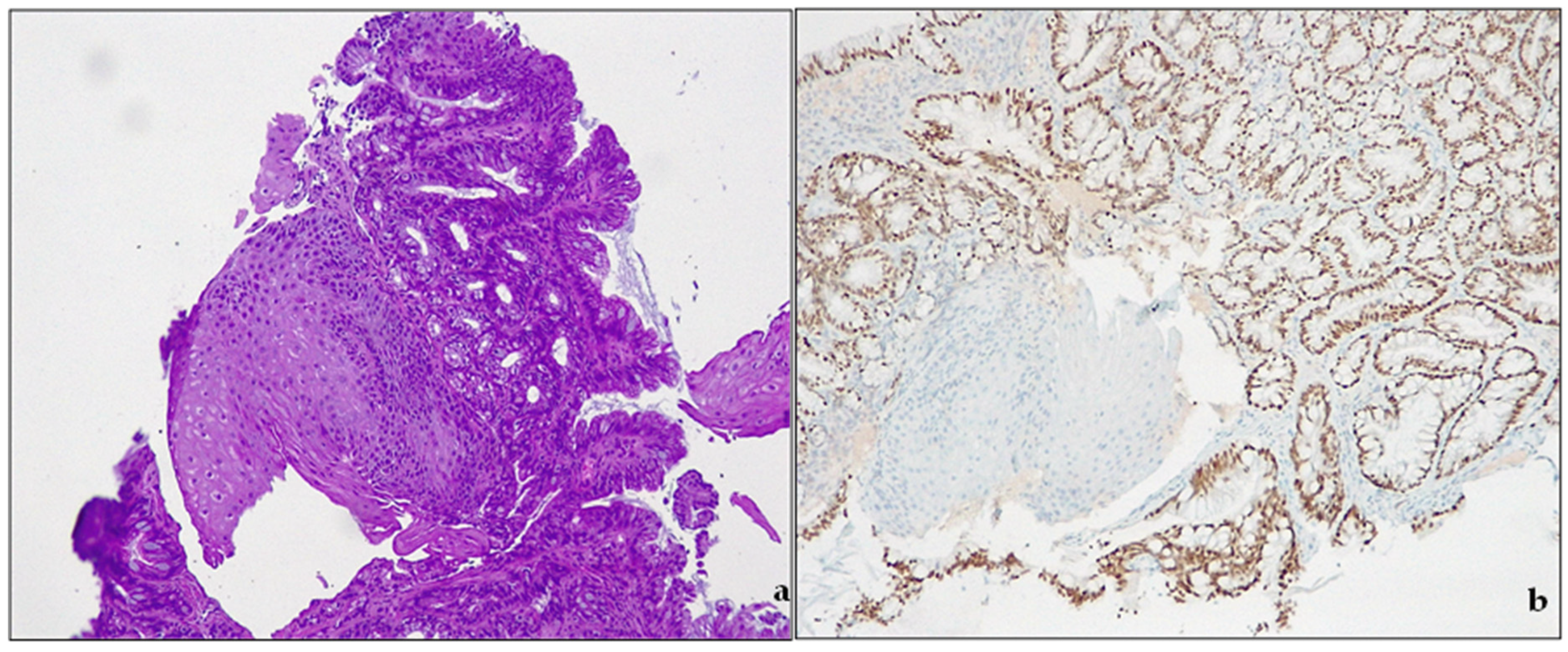 Cancers 15 05725 g003