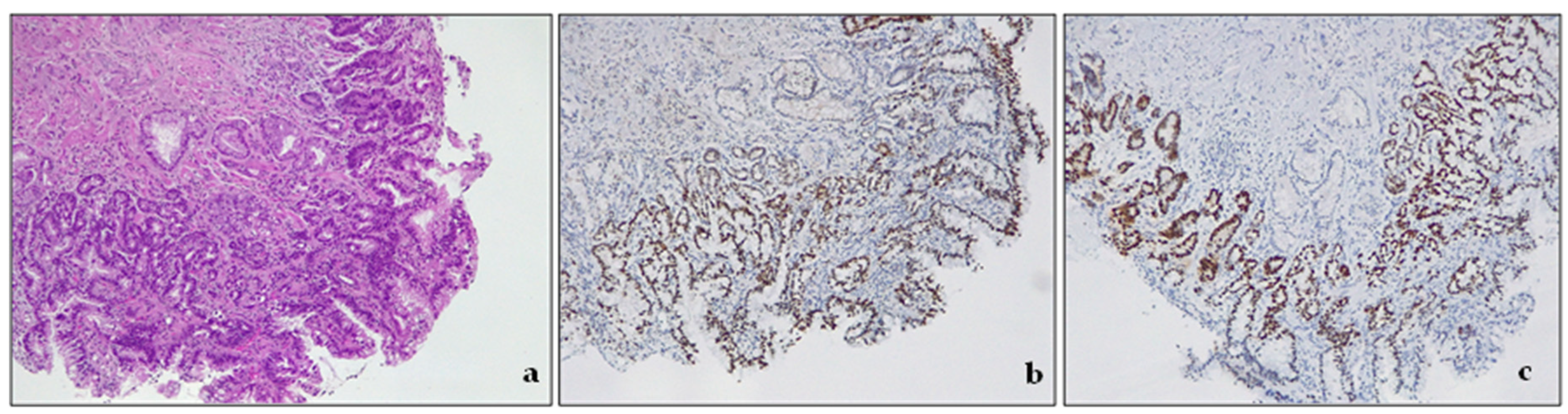 Cancers 15 05725 g004