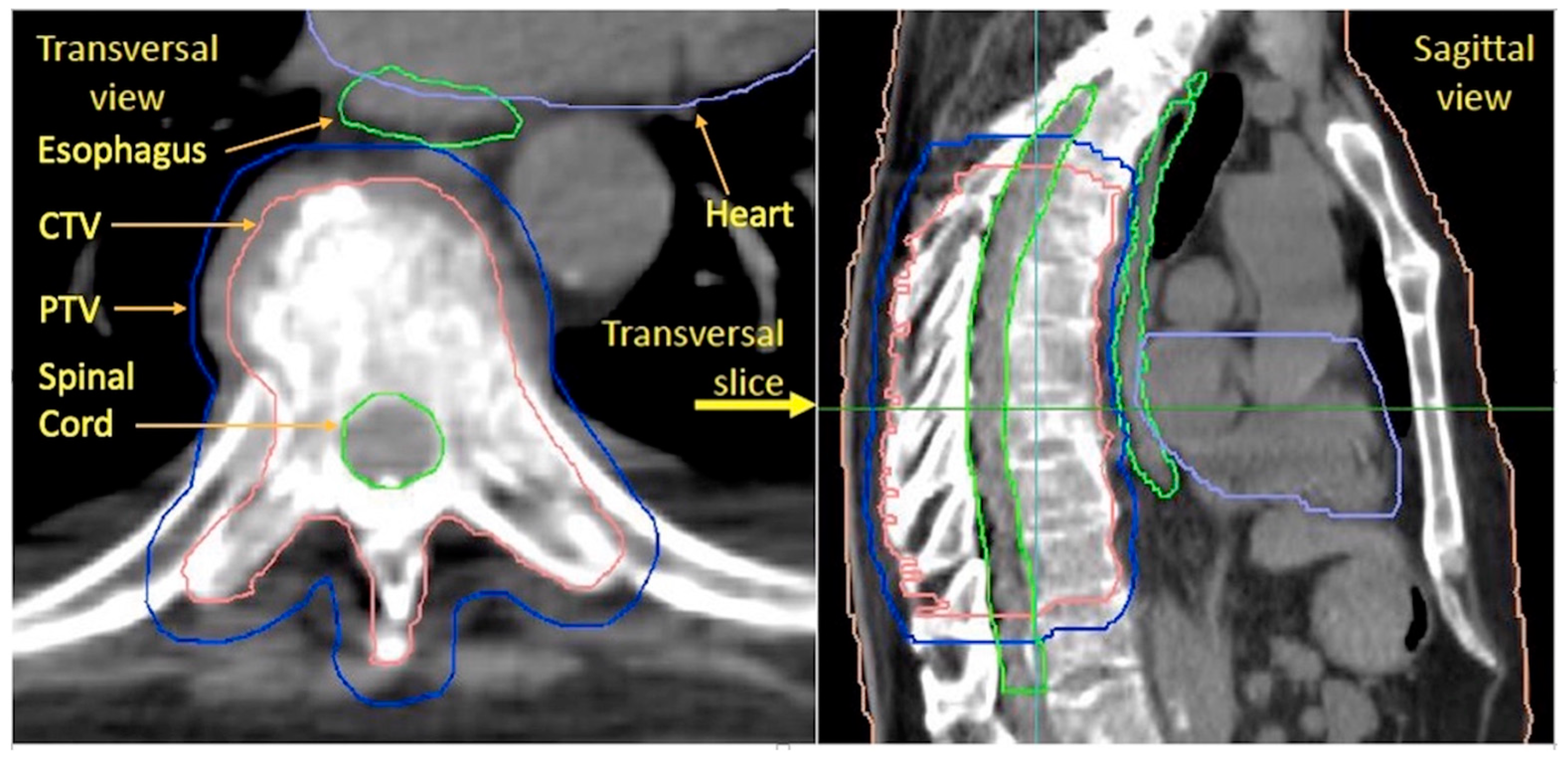 Cancers 15 05736 g001