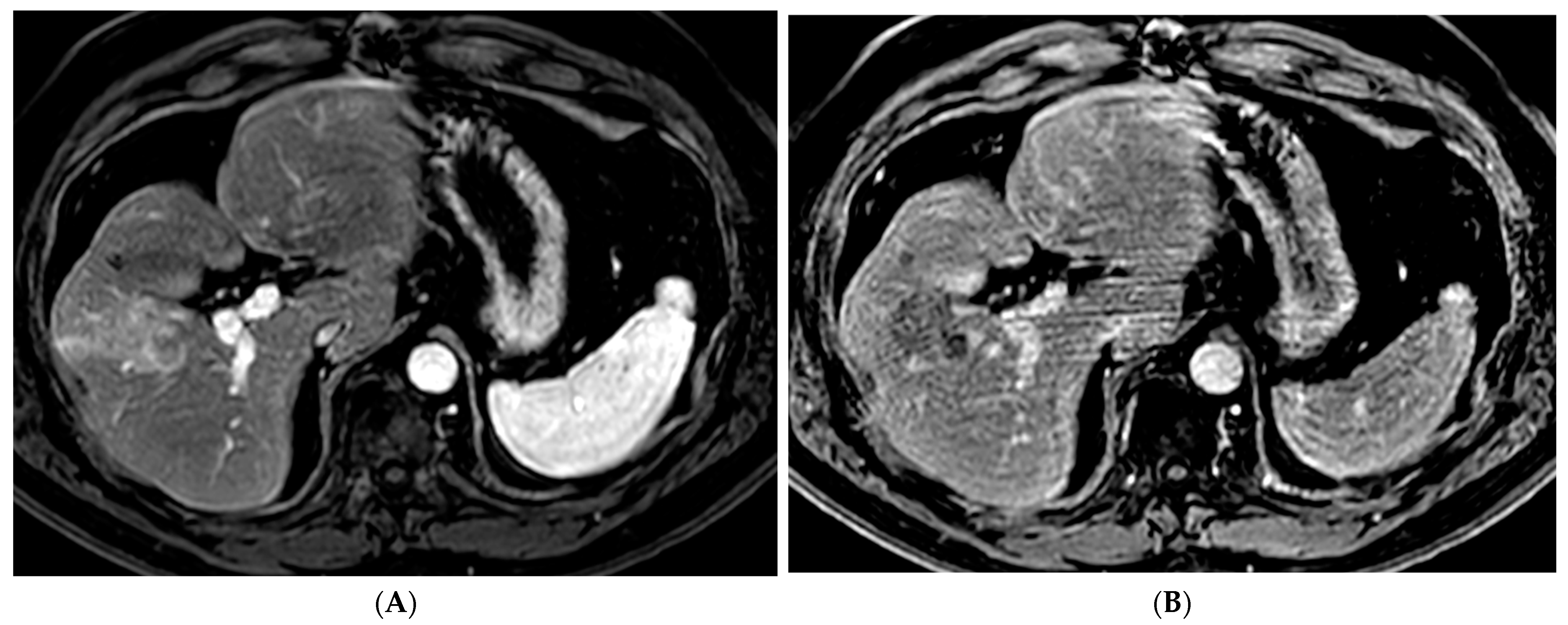 Cancers 15 05749 g003a