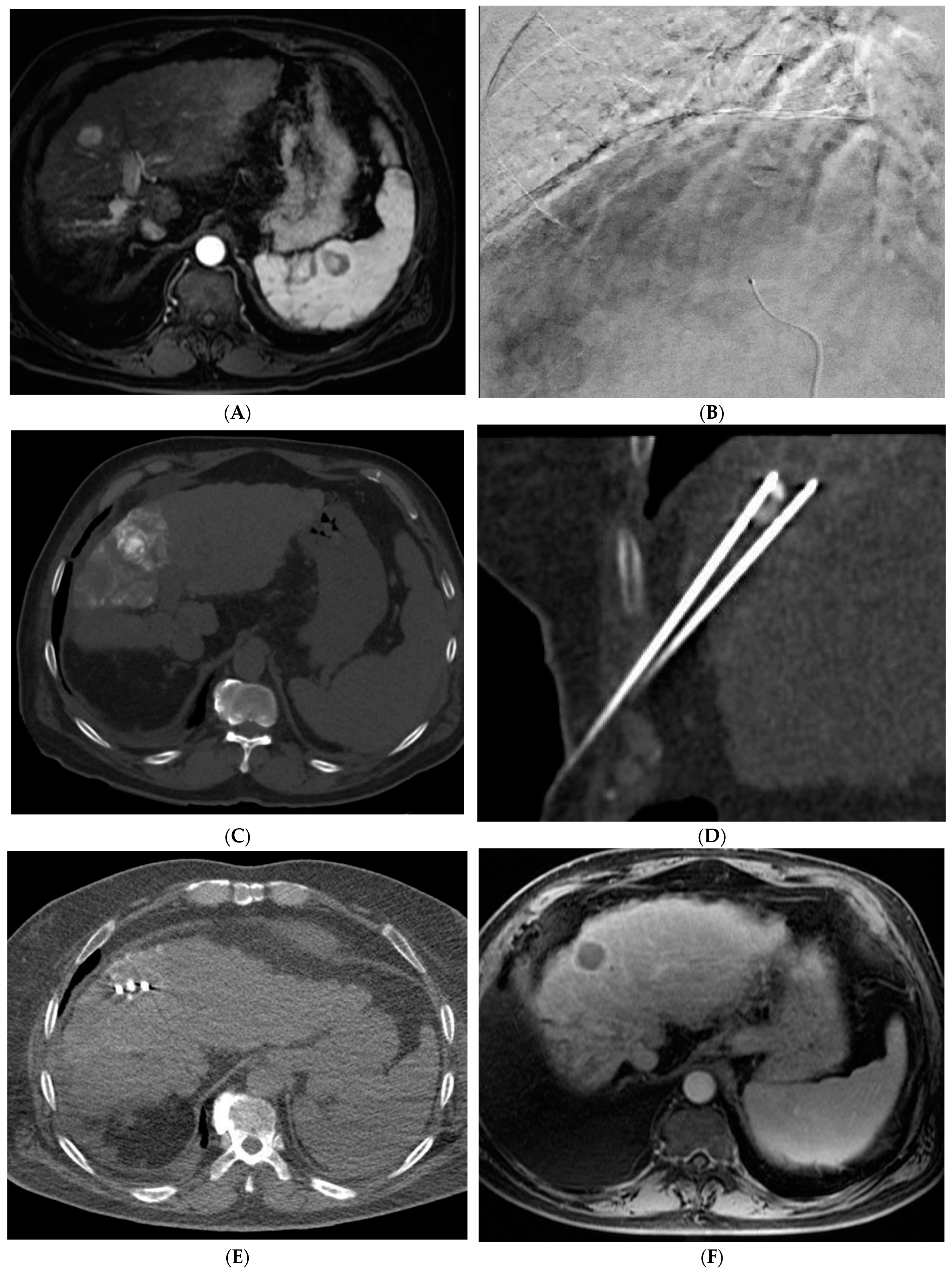 Cancers 15 05749 g004