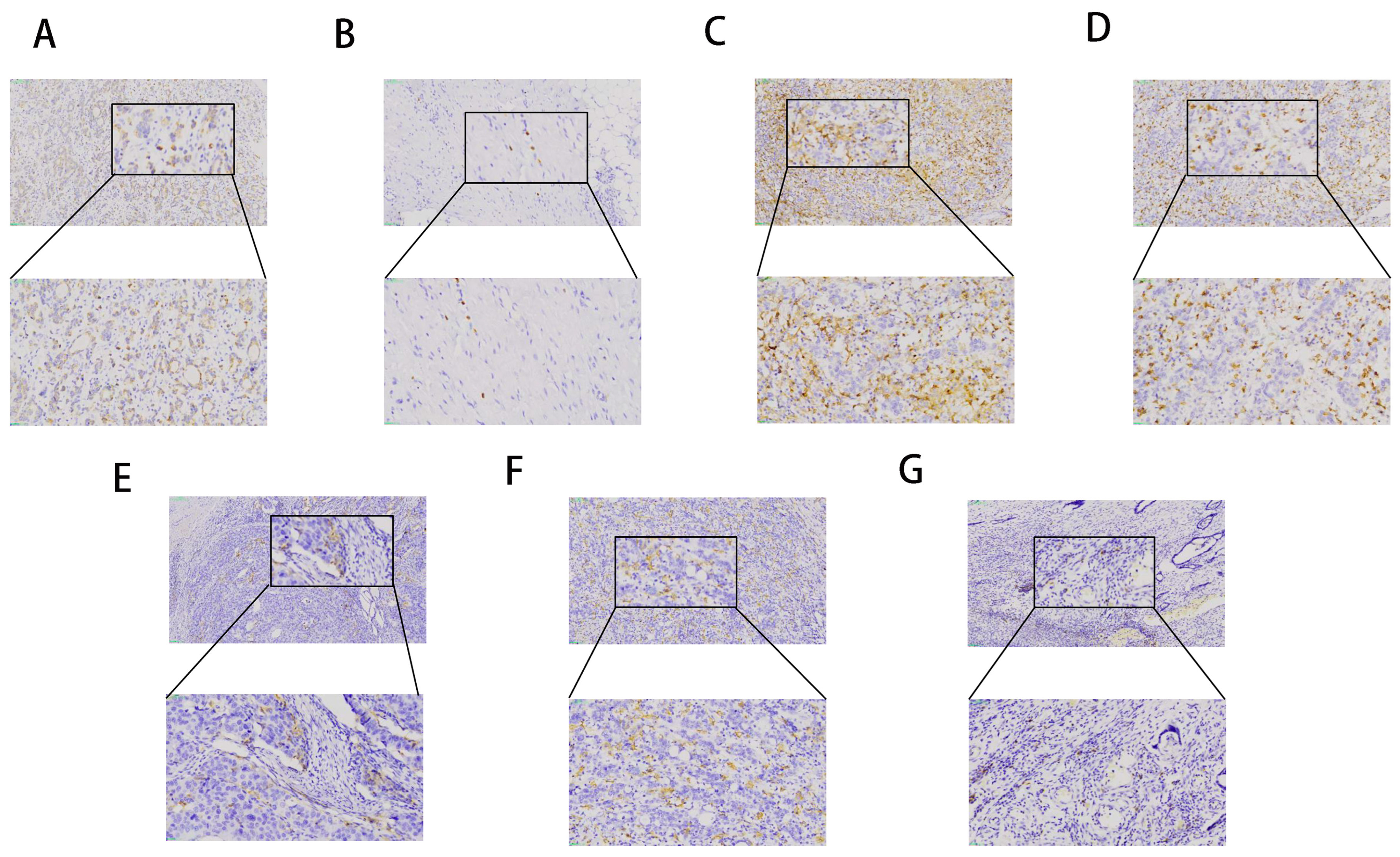 Cancers 15 05759 g005