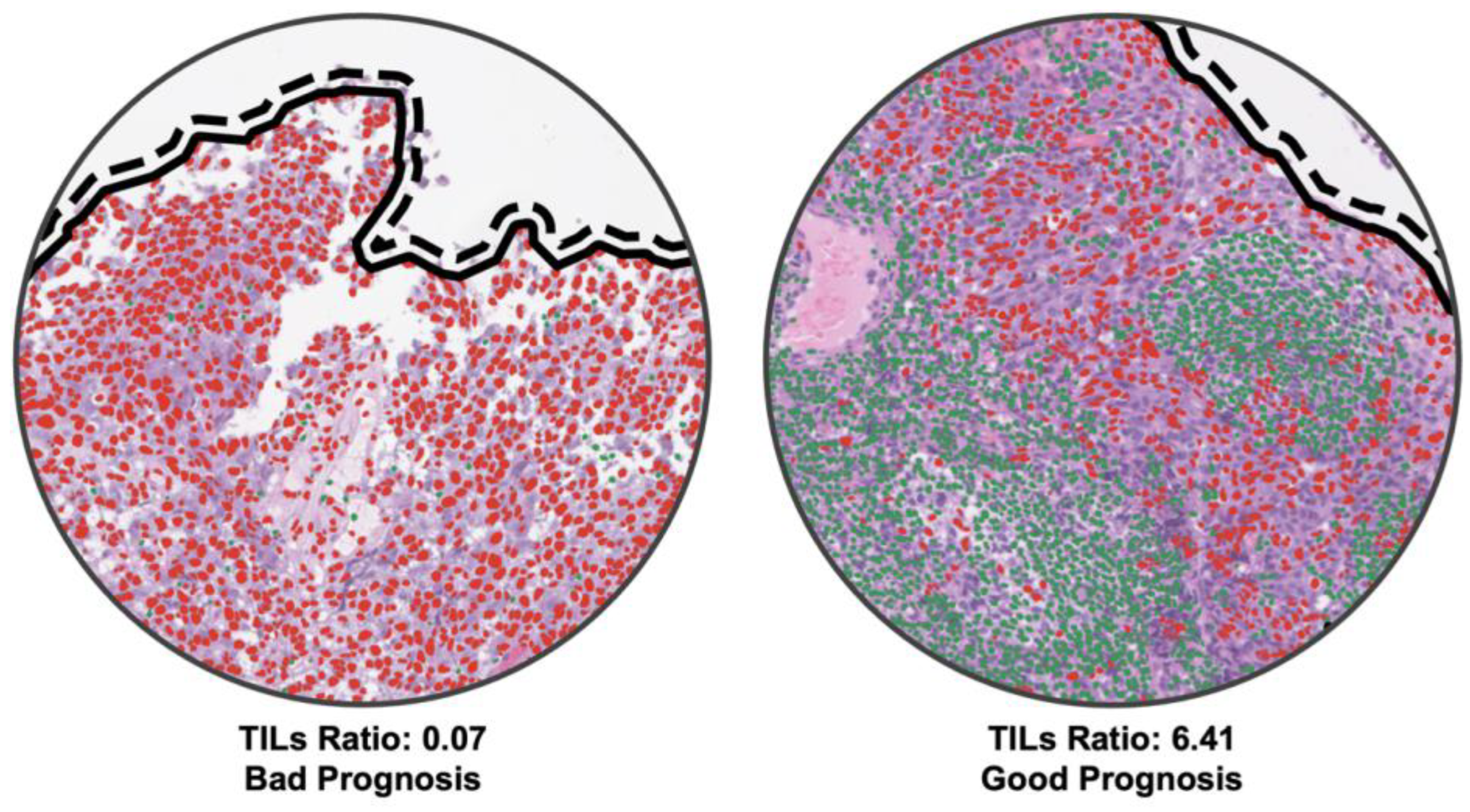 Cancers 15 05789 g005