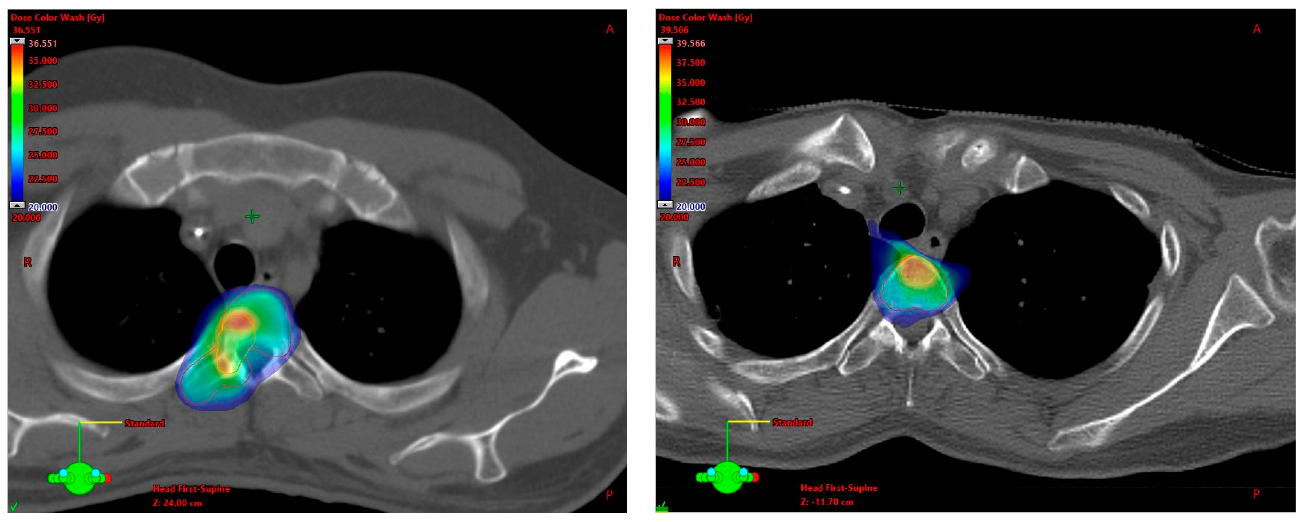 Cancers 15 05813 g001