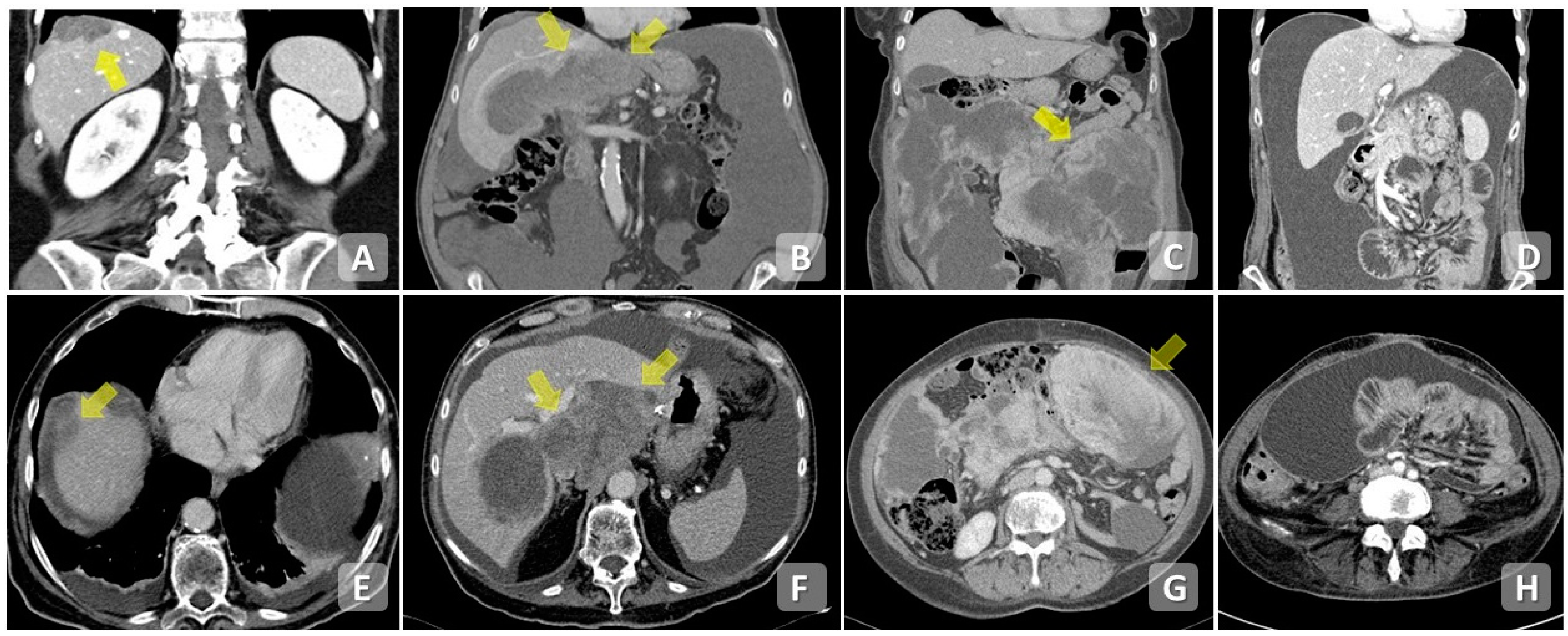 Cancers 15 05827 g002