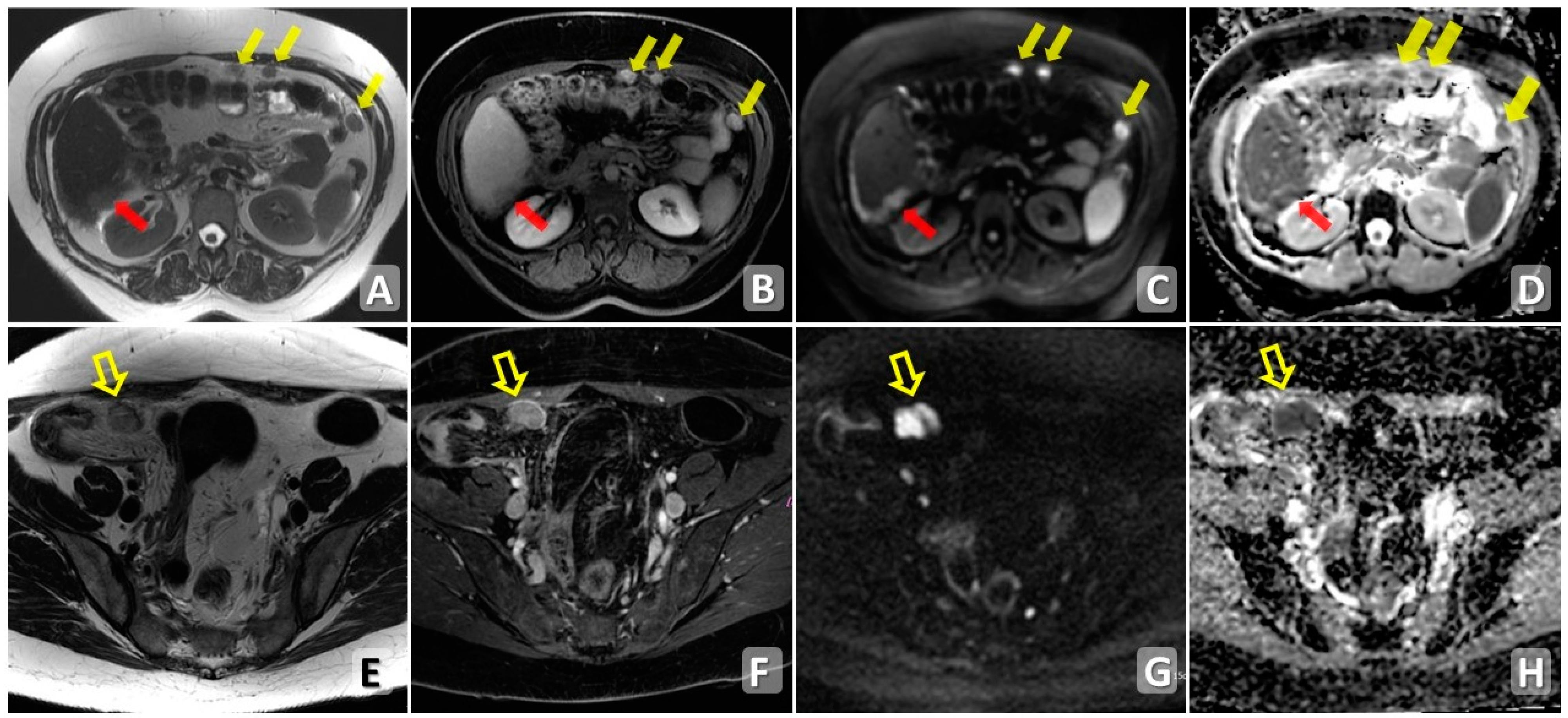 Cancers 15 05827 g003