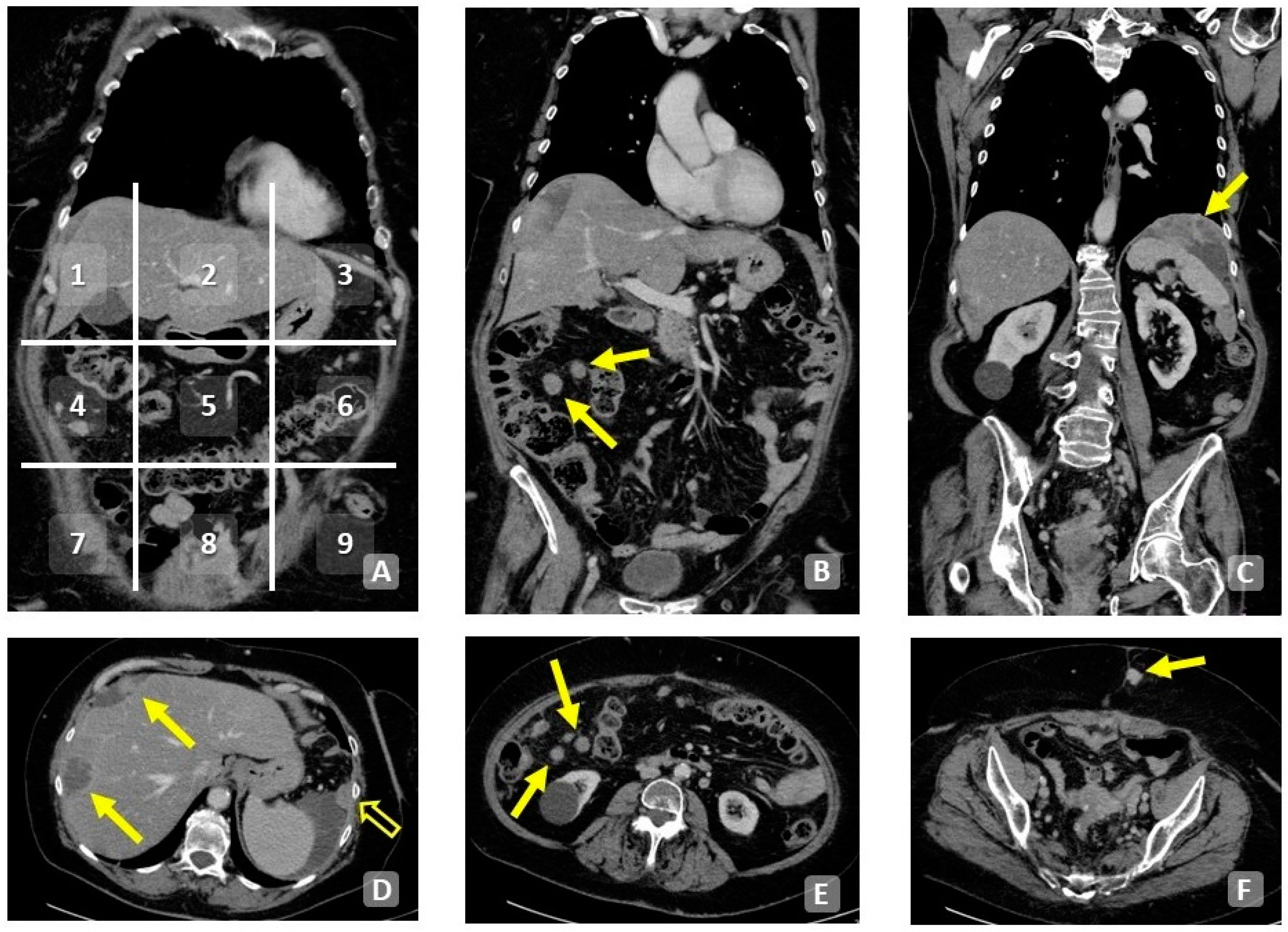 Cancers 15 05827 g006