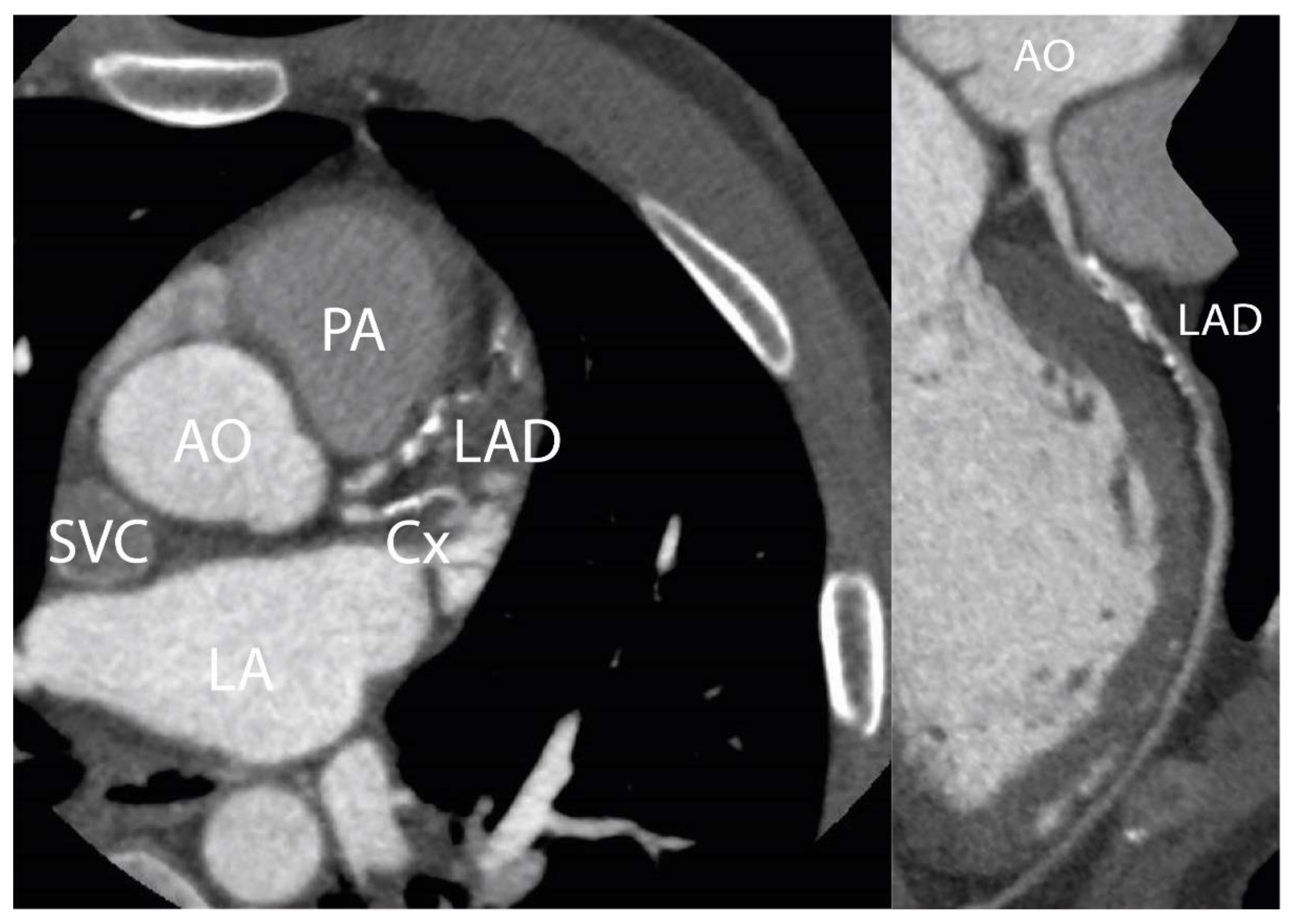 Cancers 15 05831 g003 Cancers 15 05831 g003