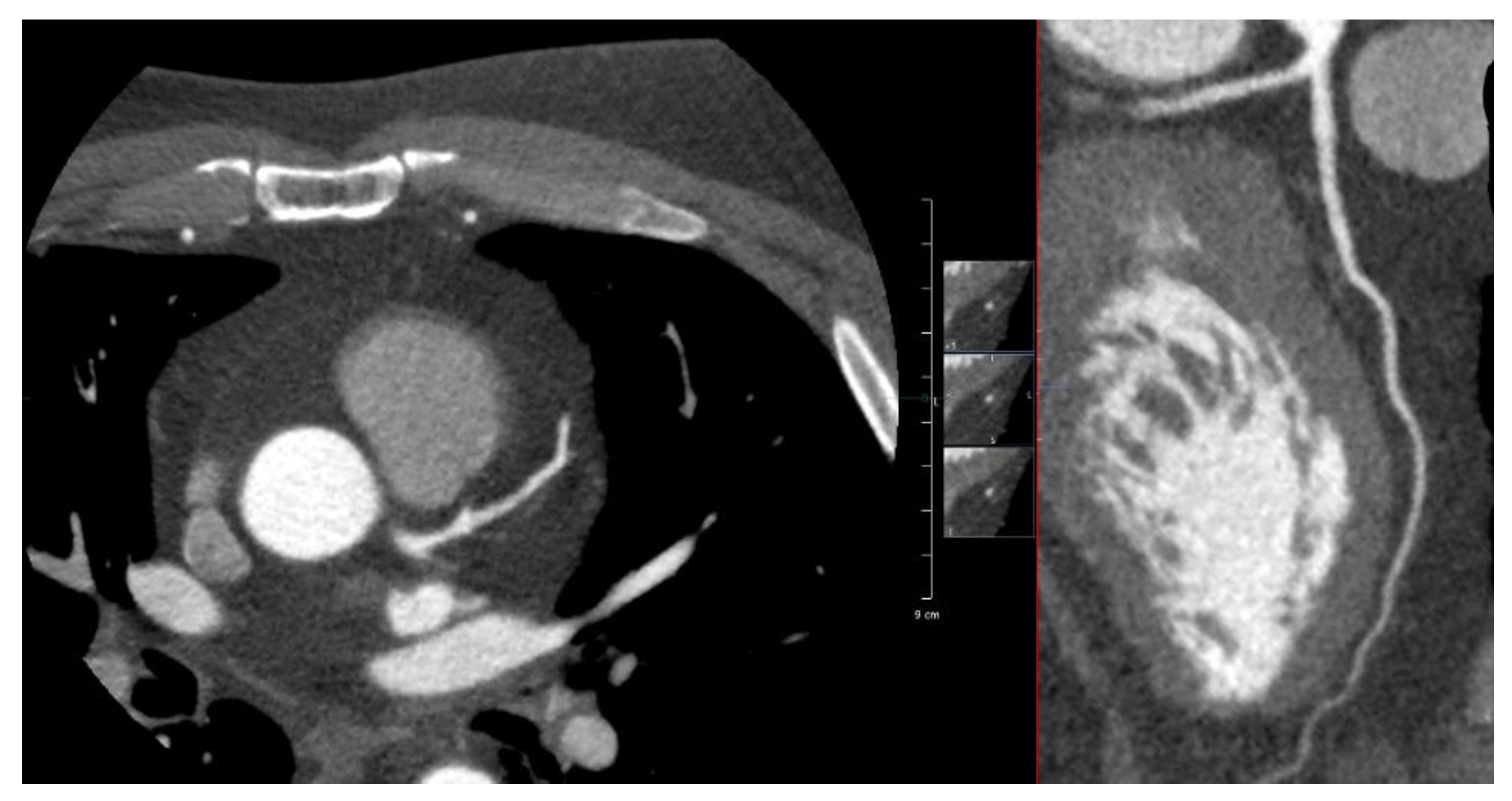 Cancers 15 05831 g0a1 Cancers 15 05831 g0a1