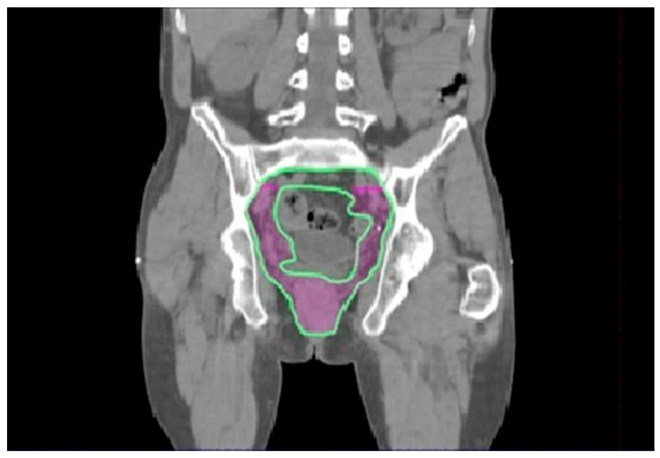 Cancers 15 05833 g004