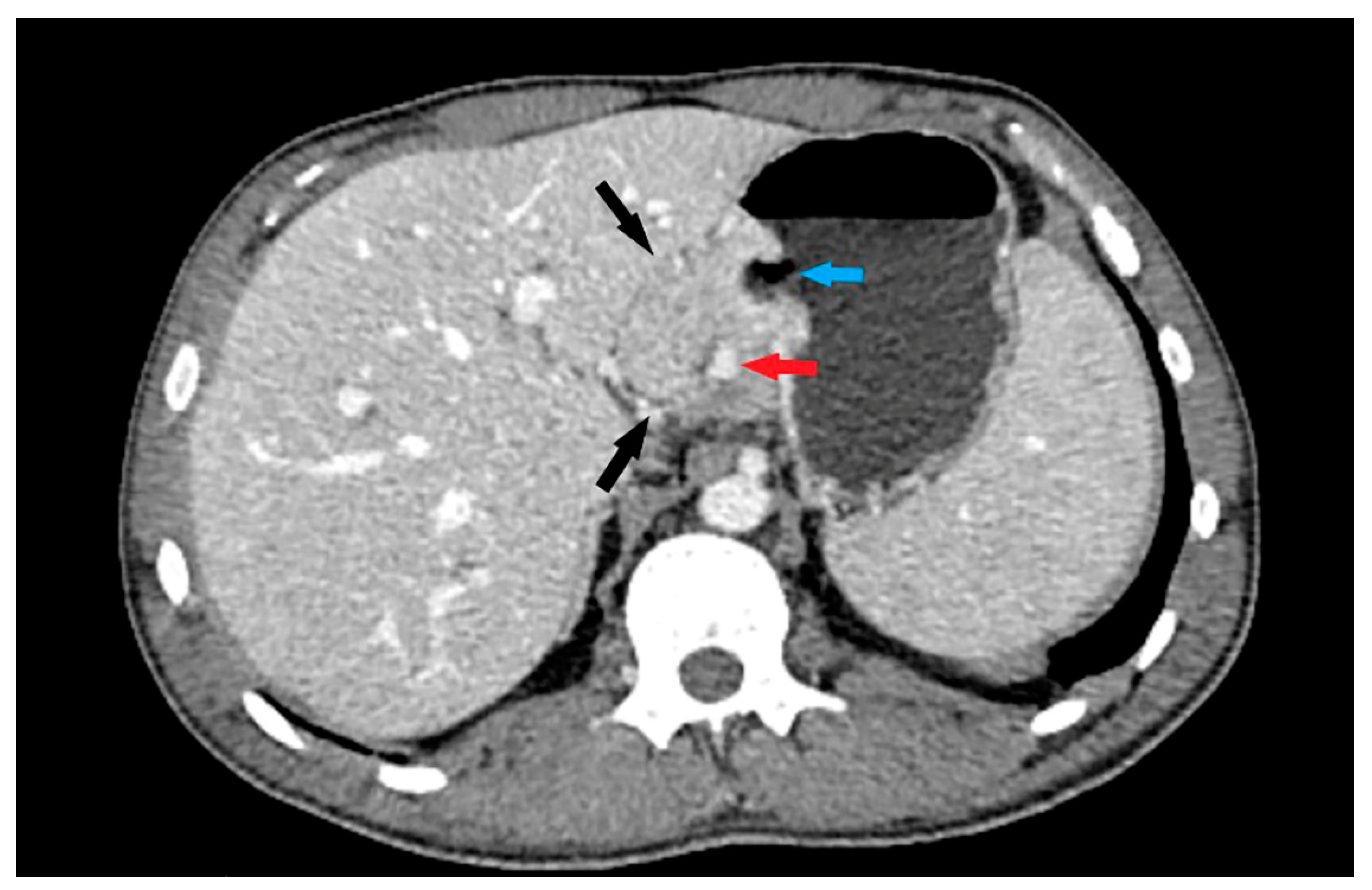 Cancers 15 05840 g002