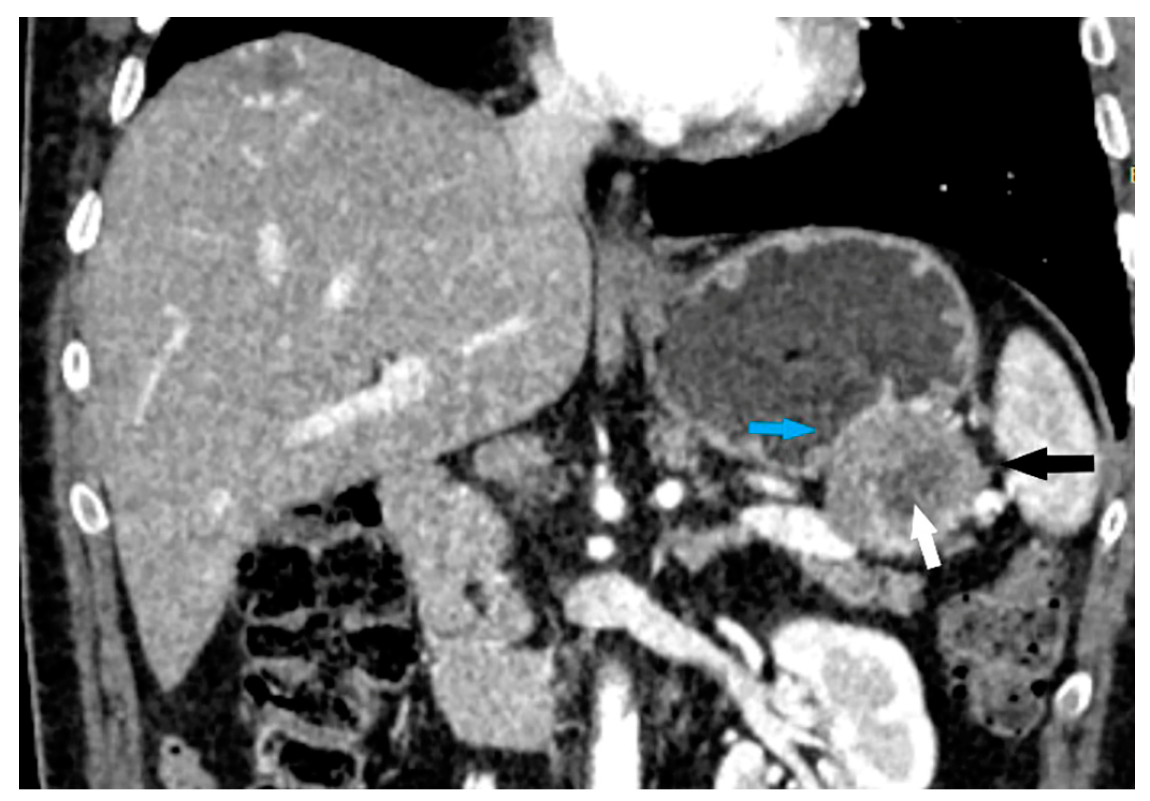 Cancers 15 05840 g003