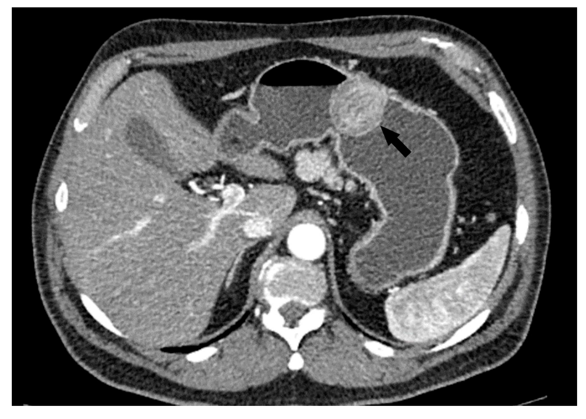 Cancers 15 05840 g005