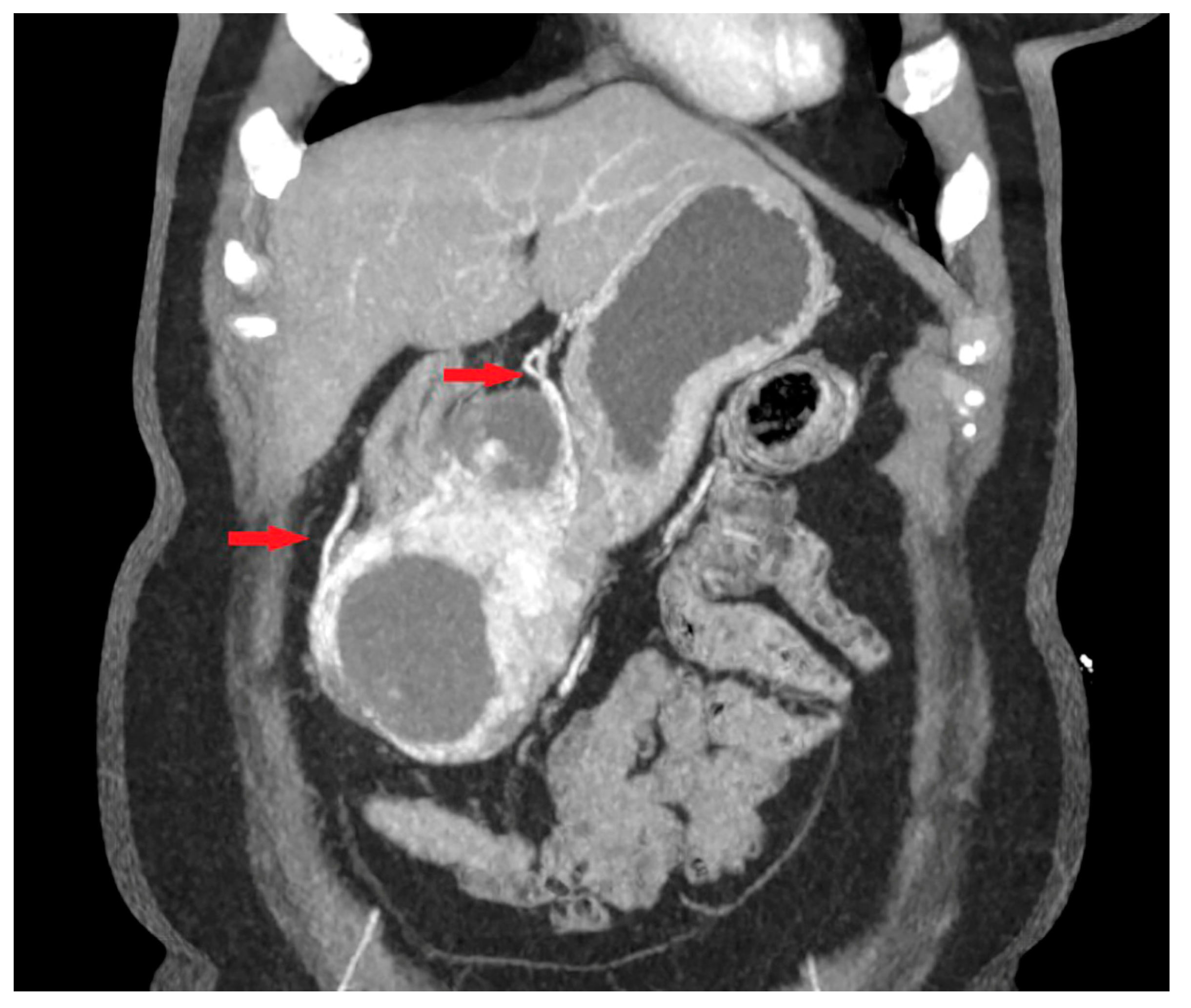 Cancers 15 05840 g006