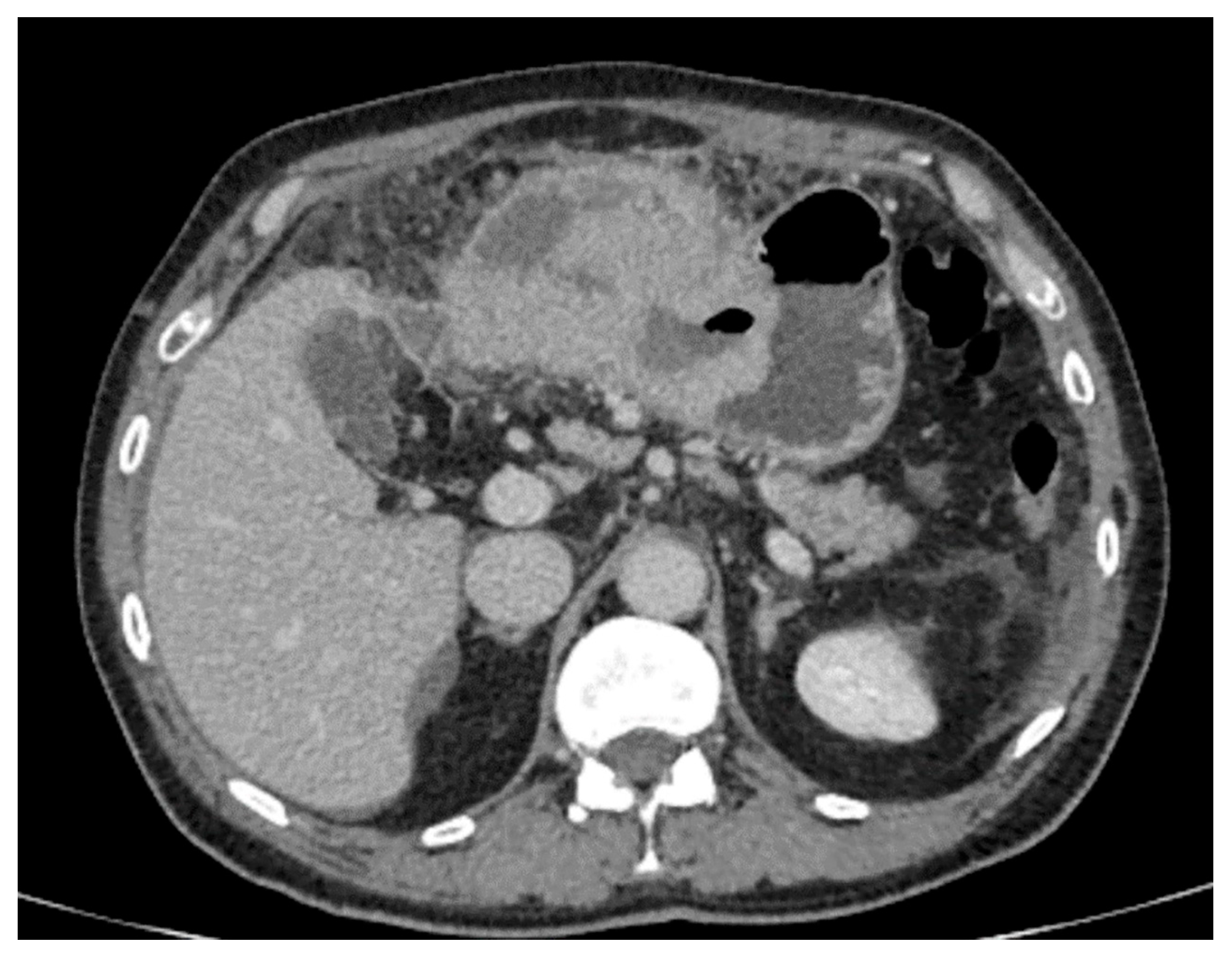 Cancers 15 05840 g007