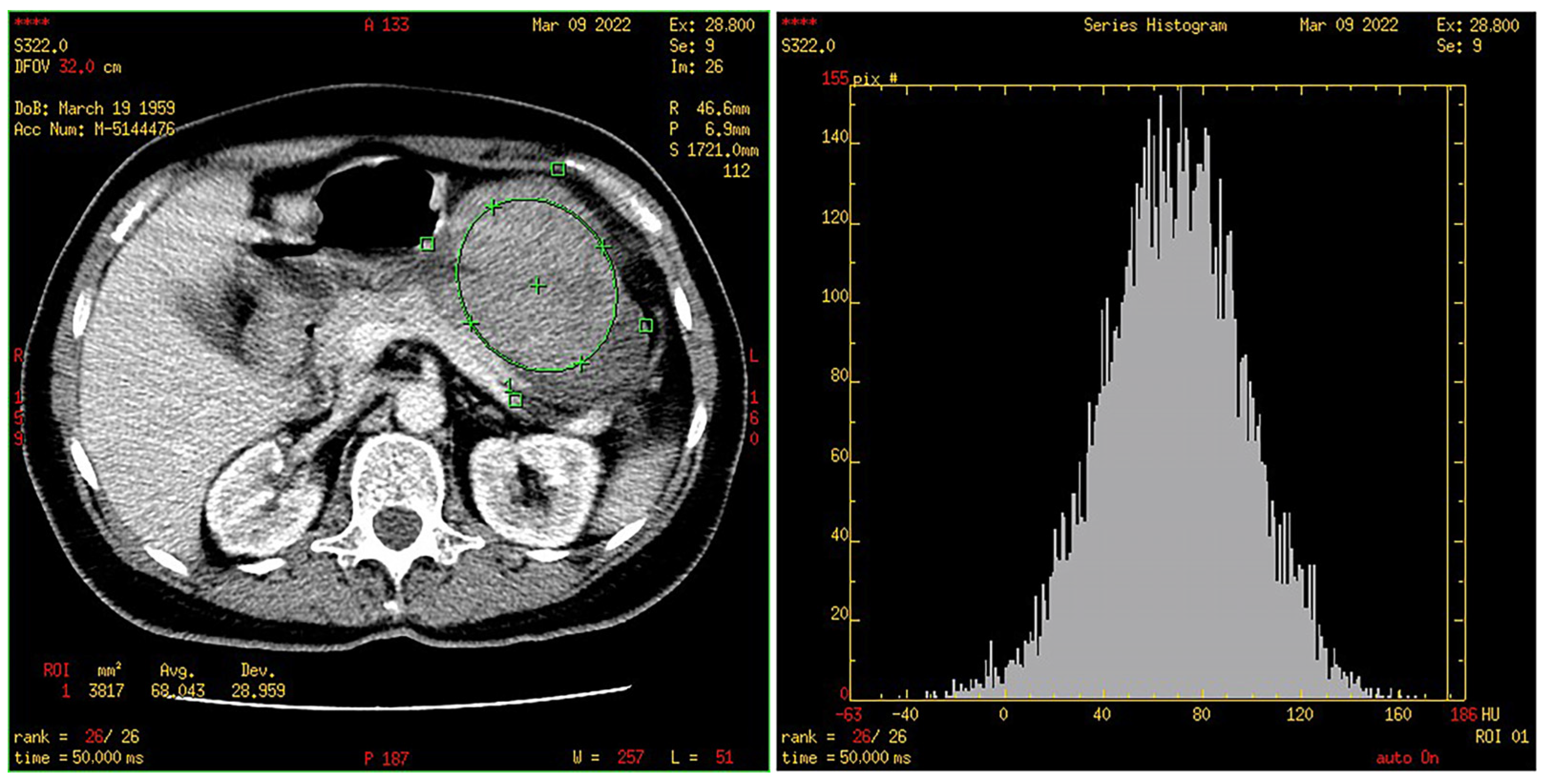 Cancers 15 05840 g008