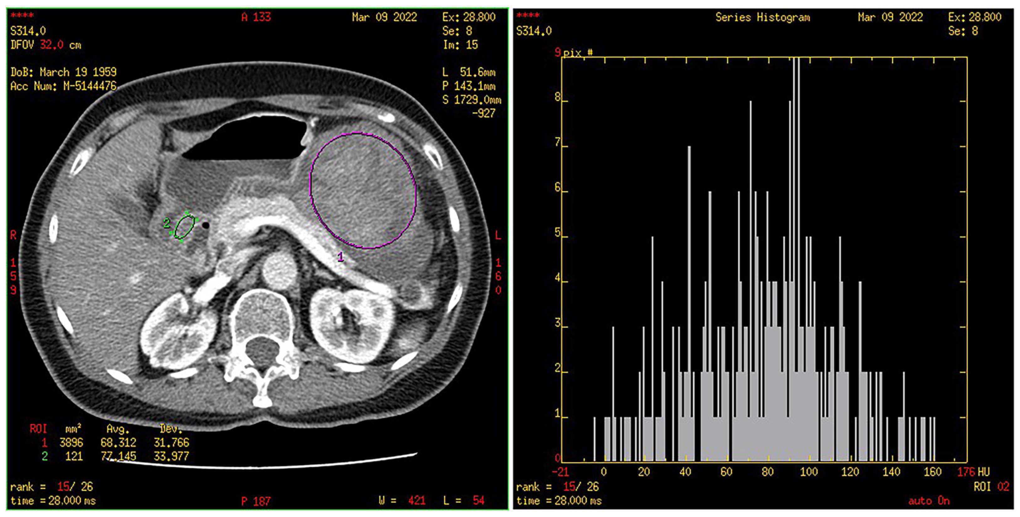Cancers 15 05840 g009