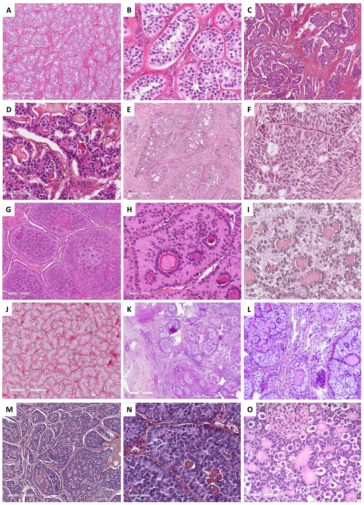 Cancers 15 05864 g010 Cancers 15 05864 g010