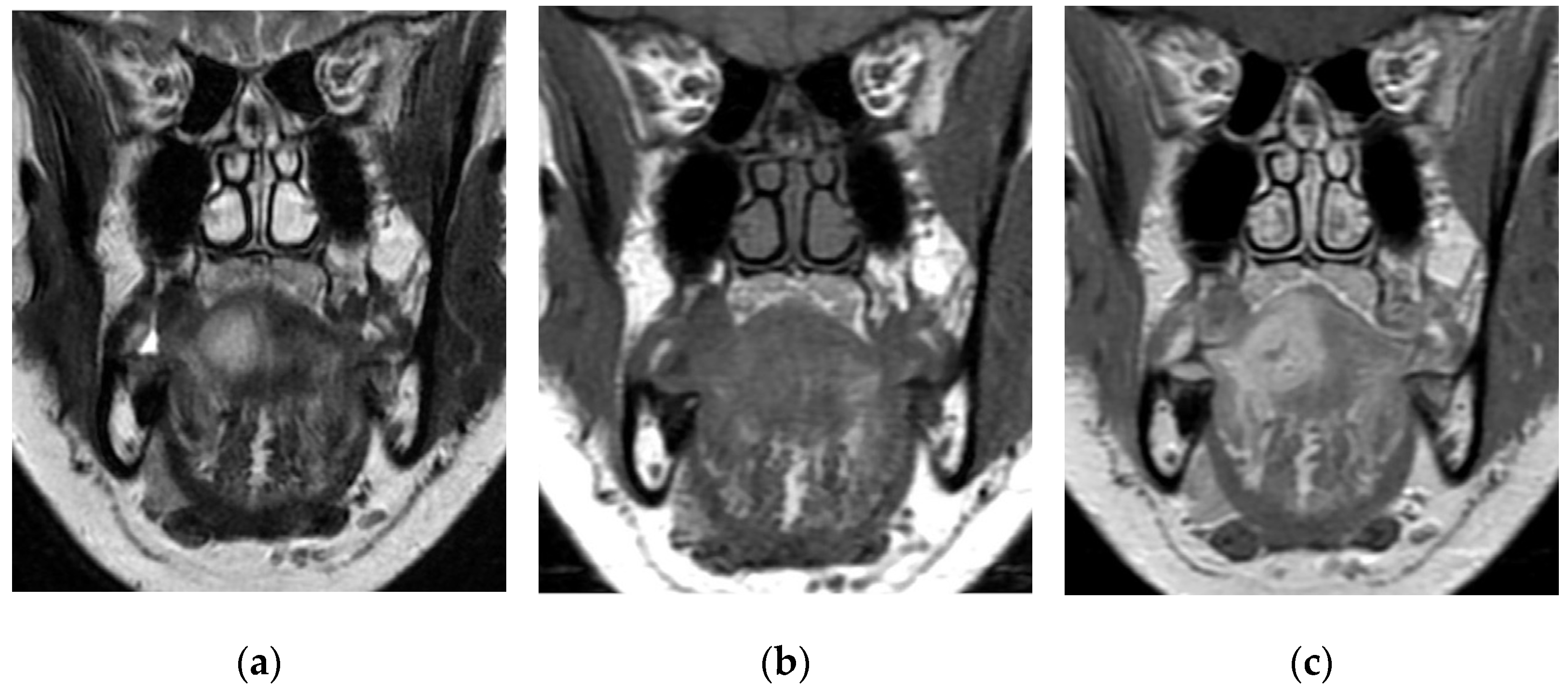 Cancers 15 05871 g001 Cancers 15 05871 g001