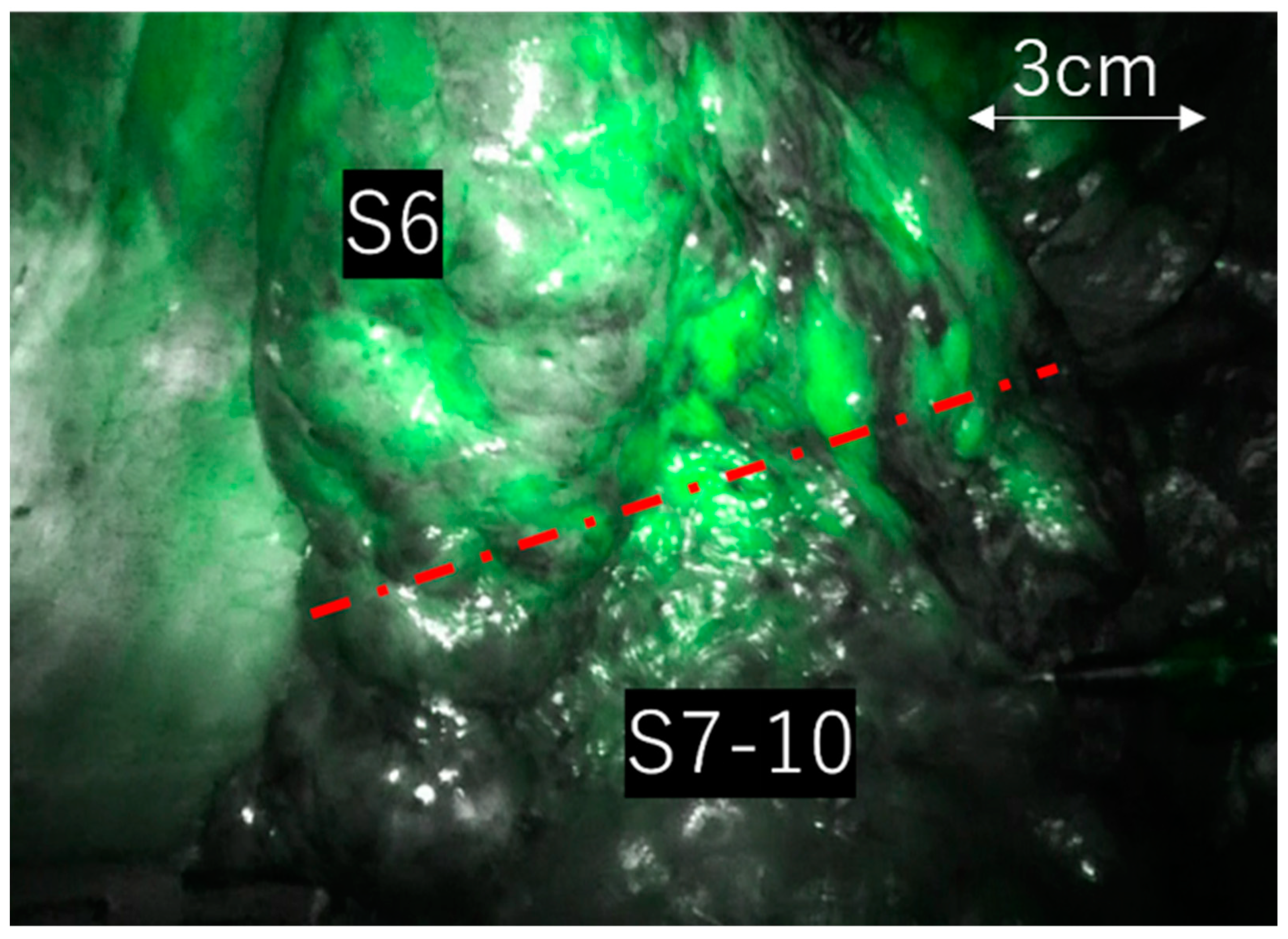 Cancers 15 05876 g001 Cancers 15 05876 g001
